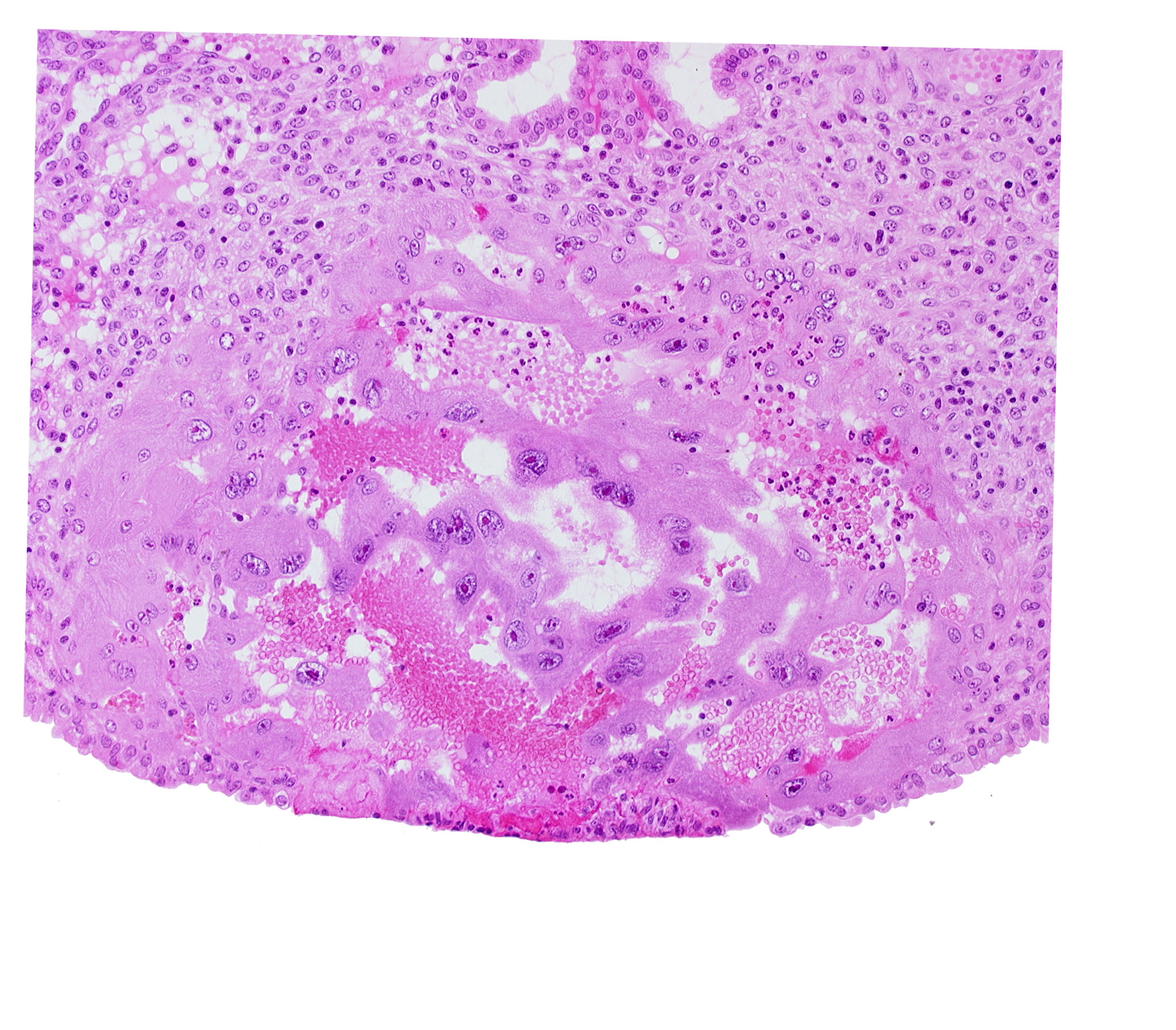 endometrial epithelium, lacunar vascular circle, syncytiotrophoblast, uterine cavity