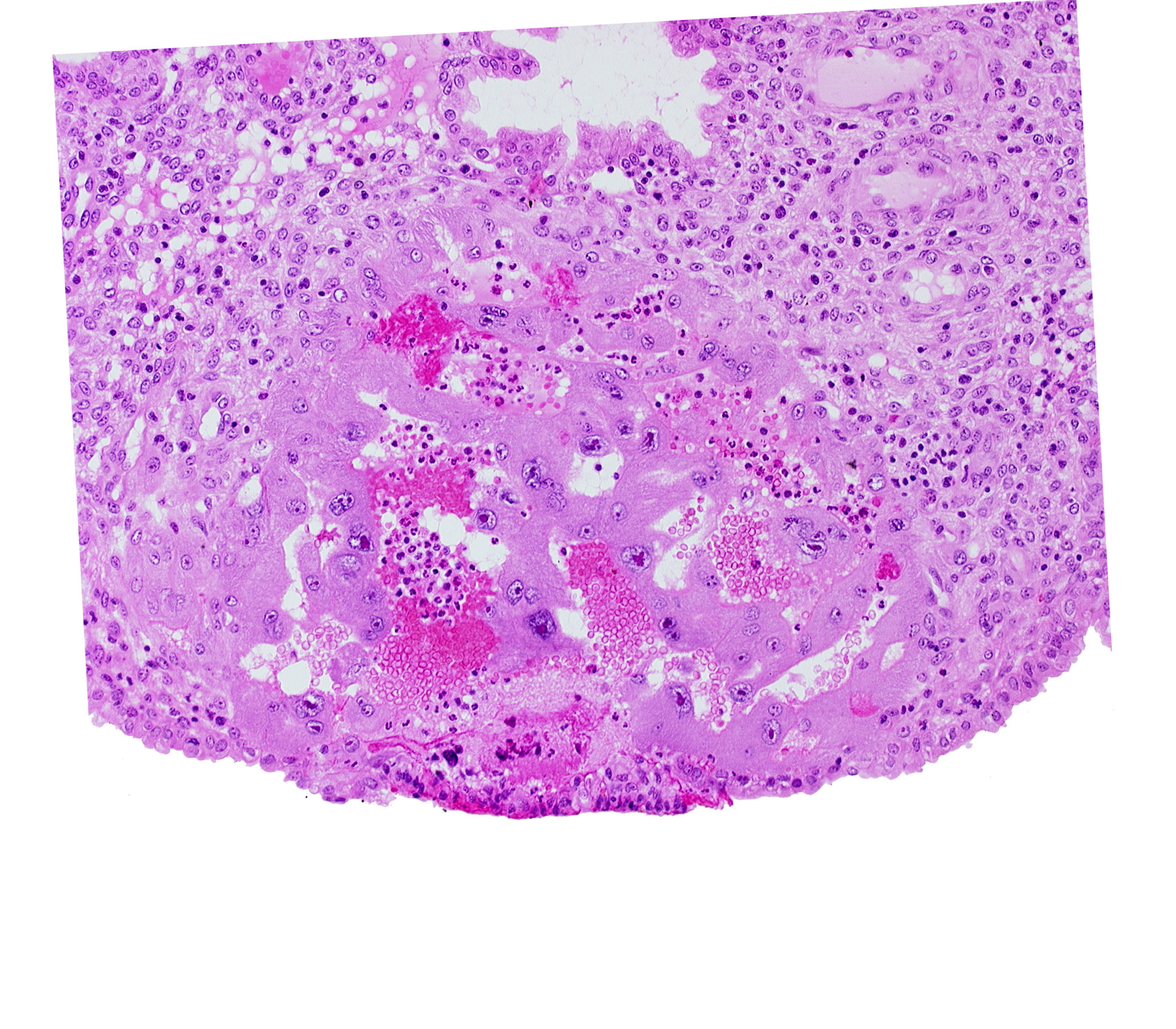 endometrial epithelium, endometrial sinusoid, lacunar vascular circle, lumen of endometrial gland, uterine cavity