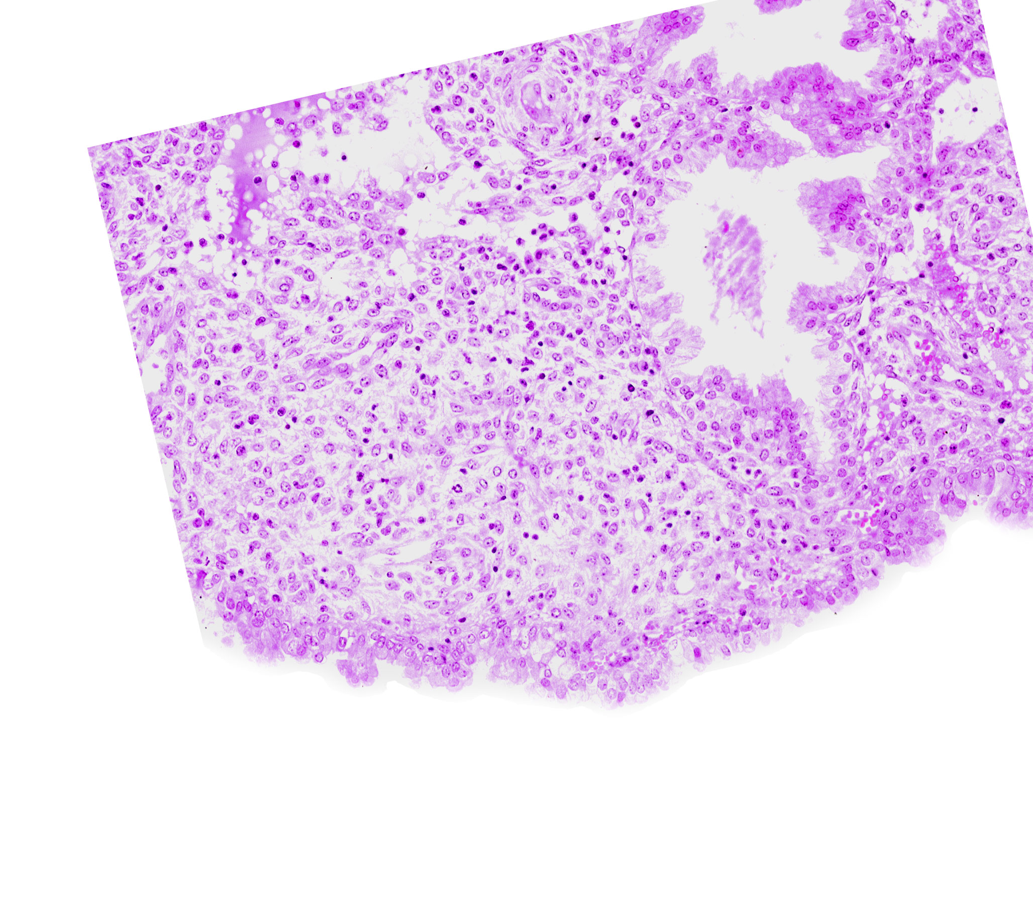 endometrial stroma (decidua), uterine cavity