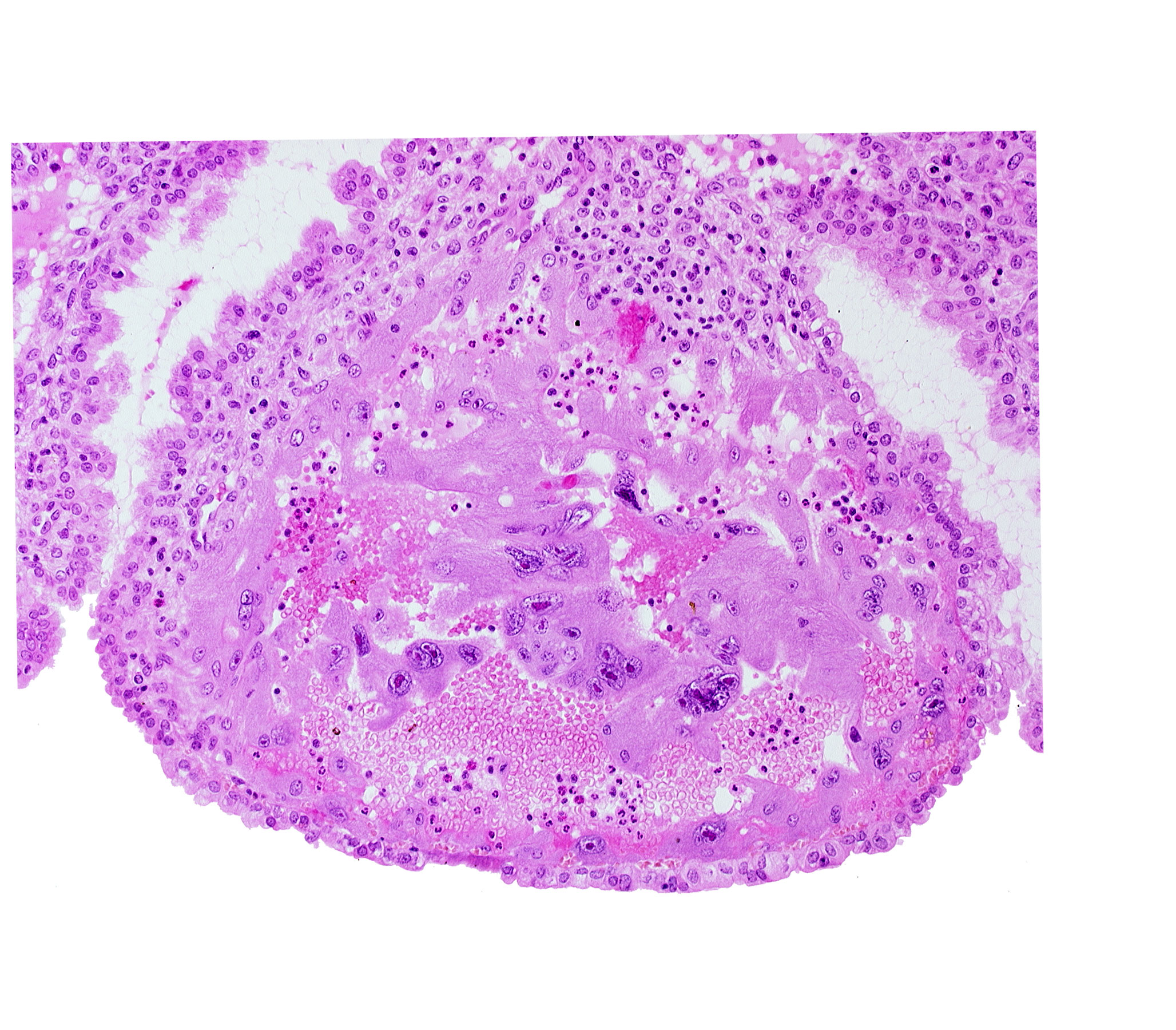 endometrial epithelium, intercommunicating lacunae, interrupted endometrial epithelium, maternal blood cells in trophoblast lacuna, mouth of endometrial gland, syncytiotrophoblast