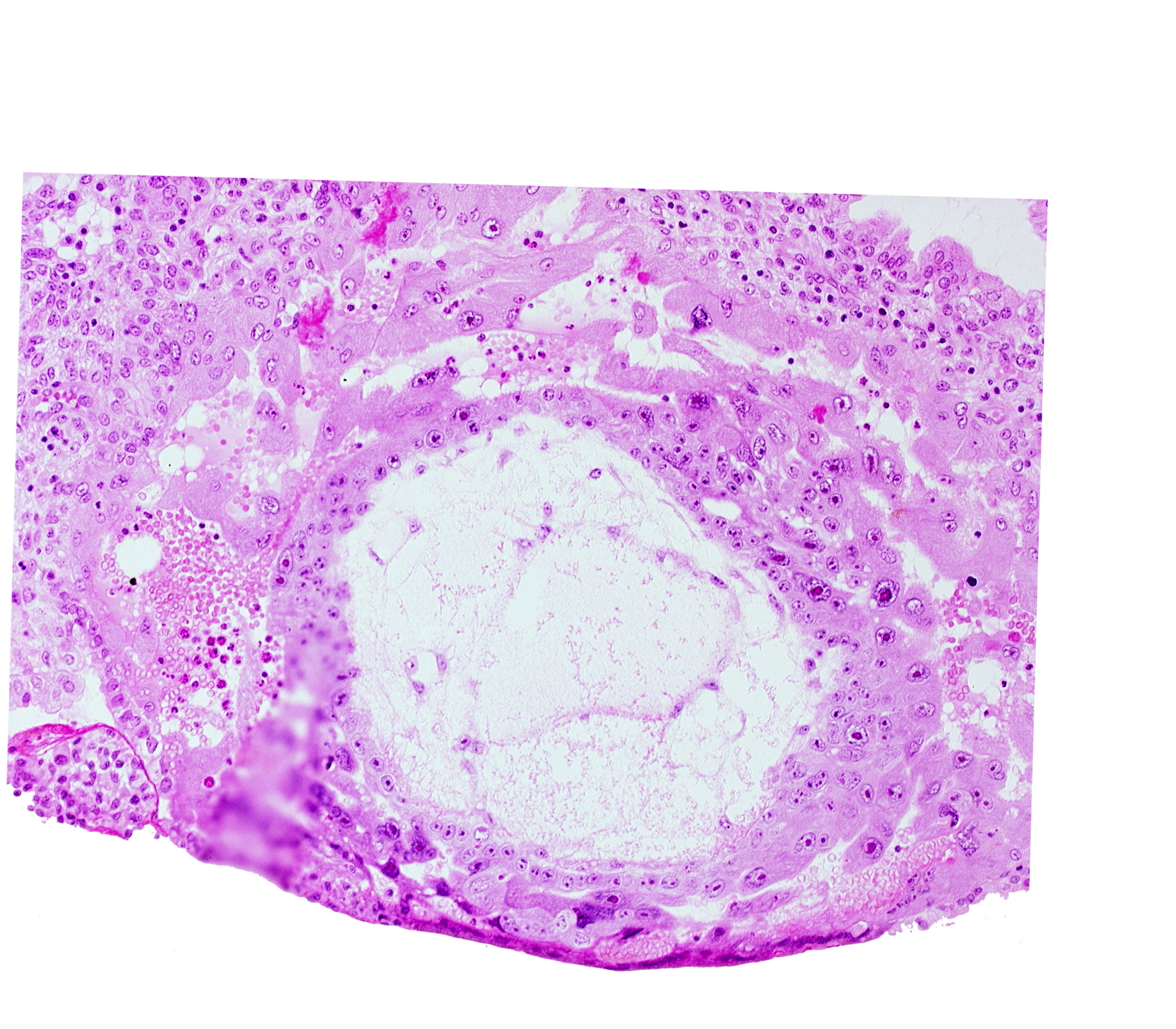 chorionic cavity, extra-embryonic reticulum, lacunar vascular circle