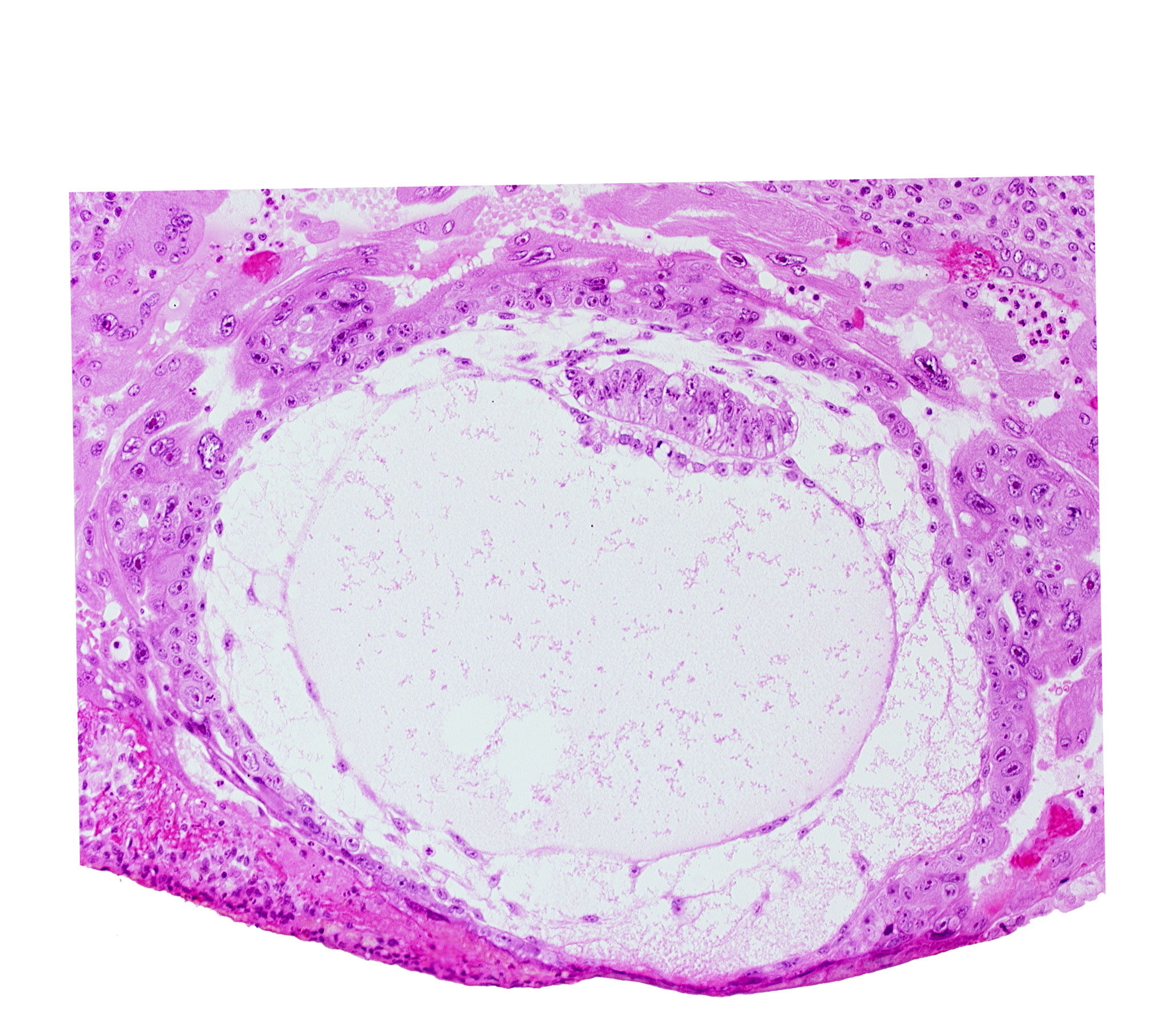 chorionic cavity, exocoelomic (Heuser's) membrane, primary umbilical vesicle cavity