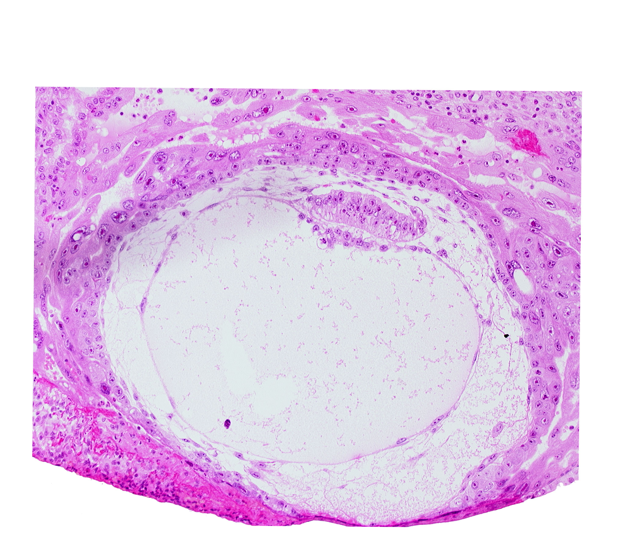 chorionic cavity, fibrous coagulum, presumptive prechordal plate, primary umbilical vesicle cavity