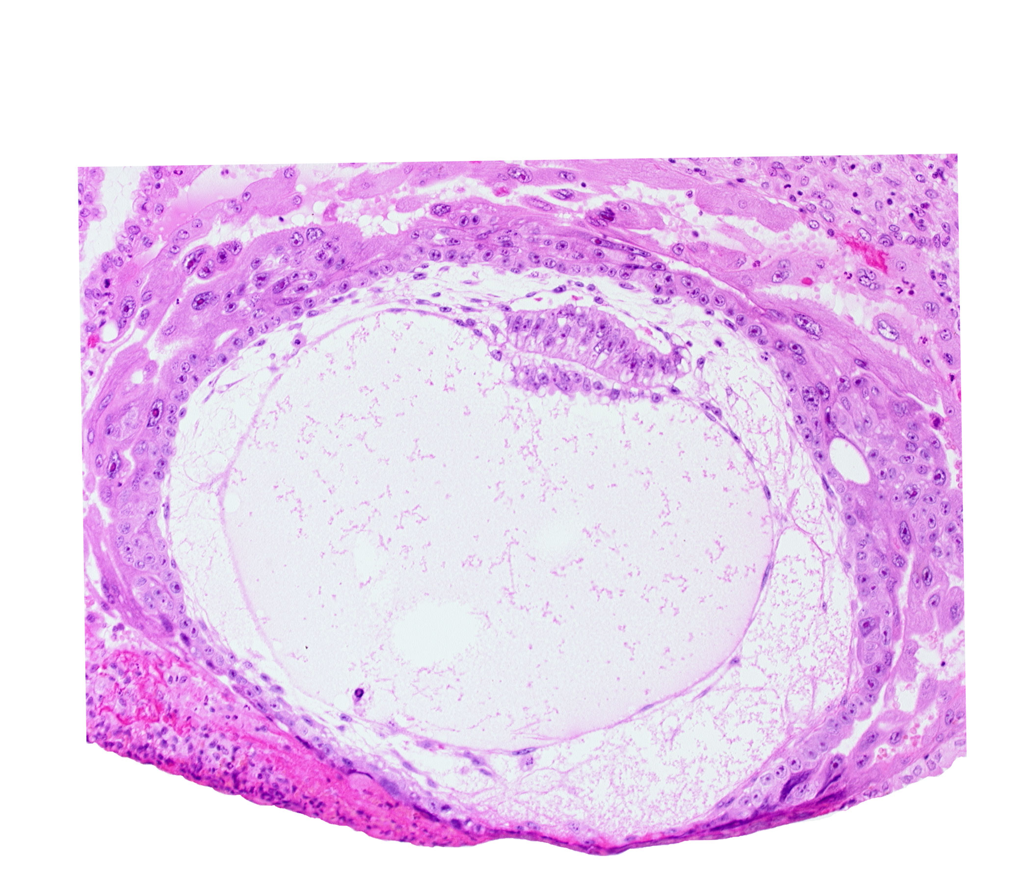 amnion, amniotic cavity, chorion, chorionic cavity, condensed extra-embryonic mesoblasts, definitive exocoelomic (Heuser's) membrane, extra-embryonic mesoblast, extra-embryonic reticulum, hypoblast, lacunar vascular circle, primary umbilical vesicle cavity, uterine cavity