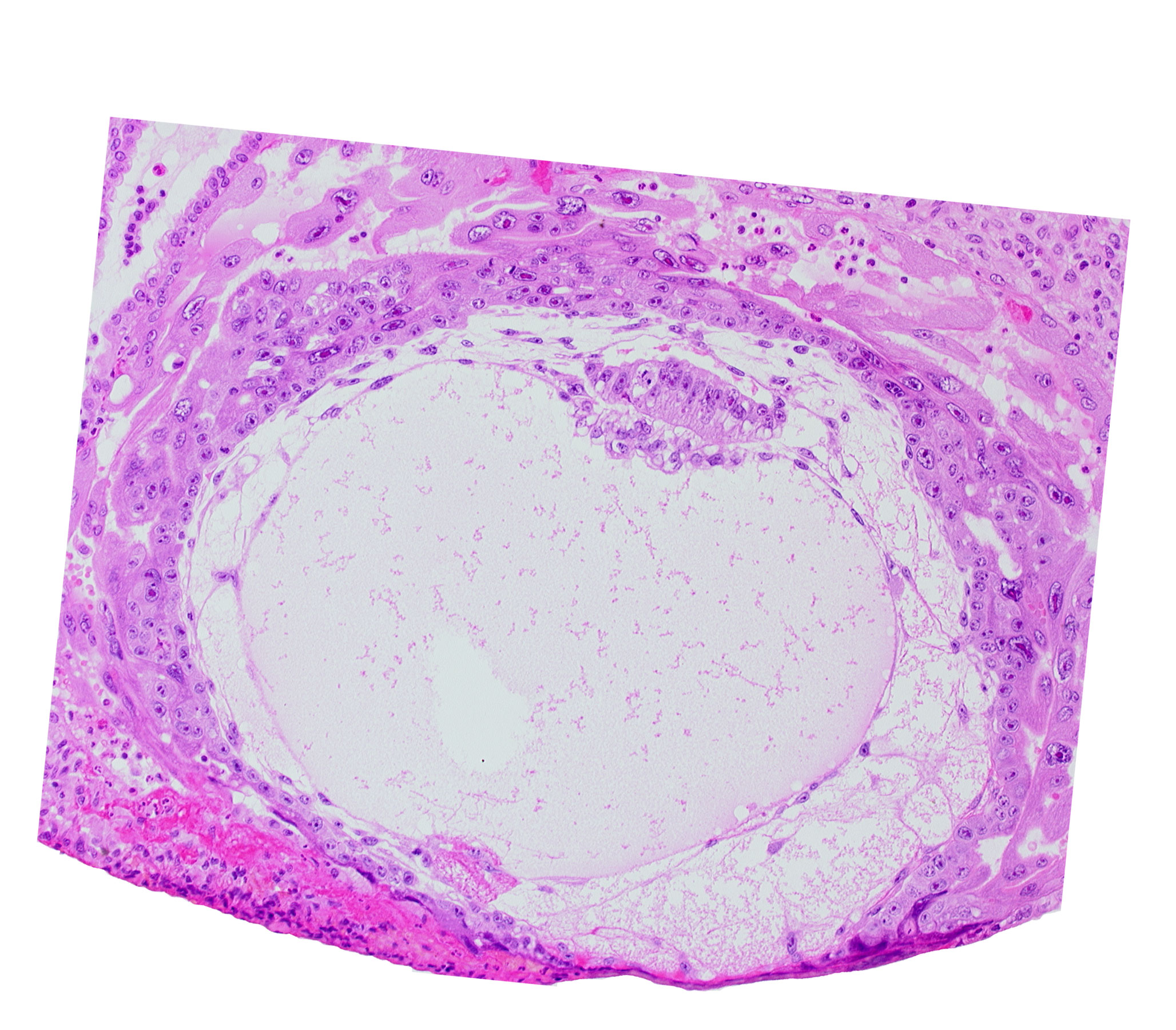 amniotic cavity, chorionic cavity, extra-embryonic reticulum, primary umbilical vesicle cavity, uterine cavity