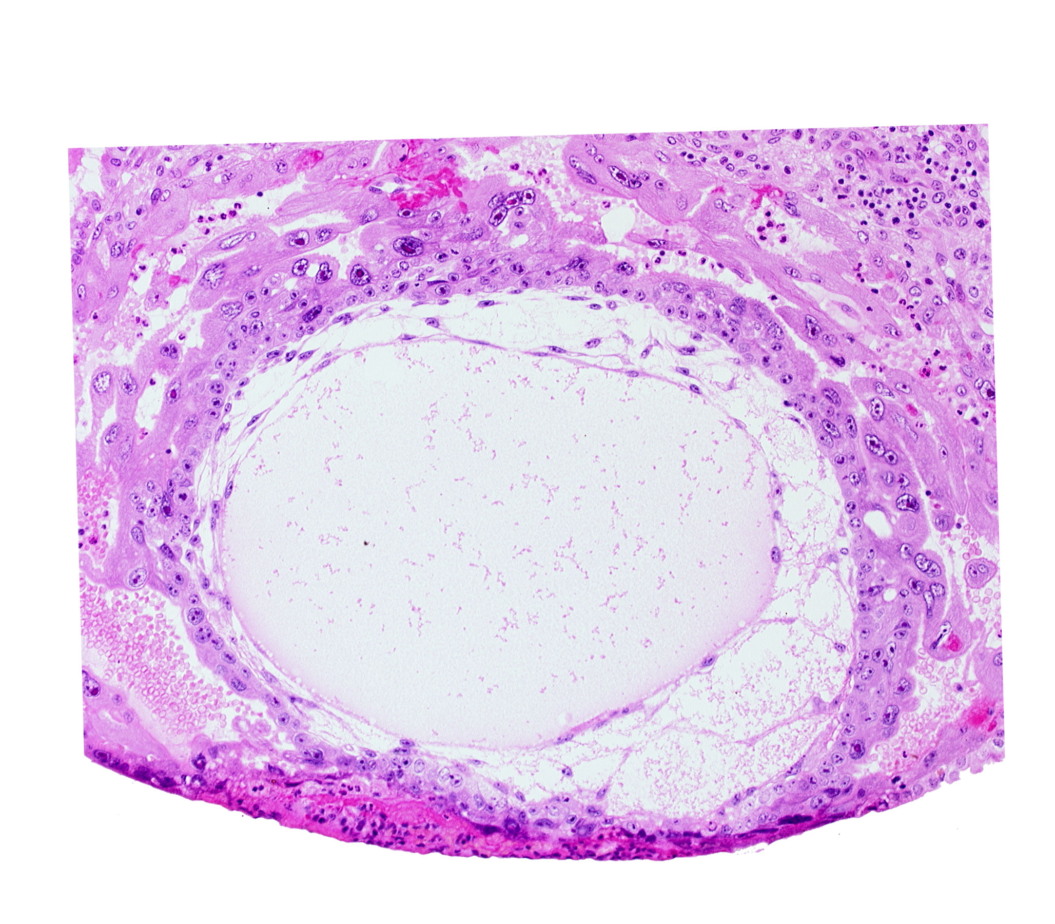 chorionic cavity, cytotrophoblast, lacunar vascular circle, primary umbilical vesicle cavity, syncytiotrophoblast