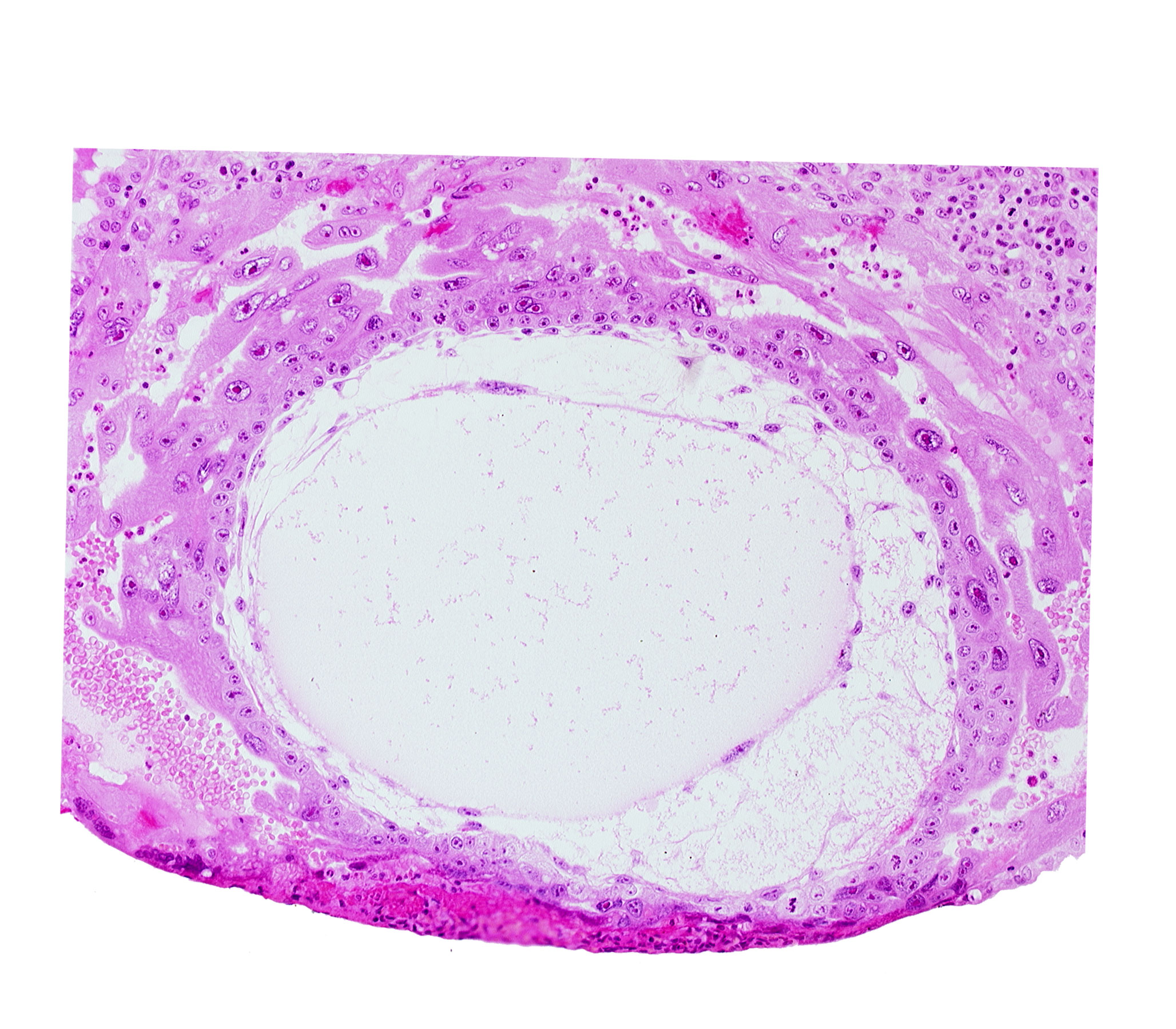 chorionic cavity, definitive exocoelomic (Heuser's) membrane, lacunar vascular circle, uterine cavity