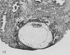 Section through middle of specimen