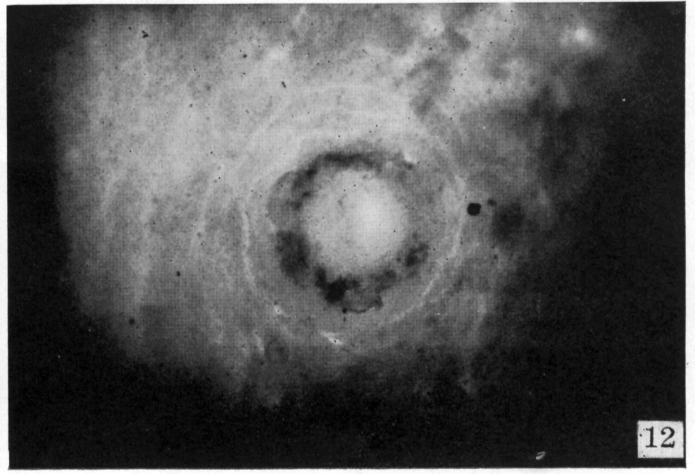 Implantation site in cleared celloidin block