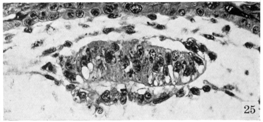 High-power view of embryo