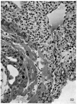 Arteriovenous sinusoid and capillary branch