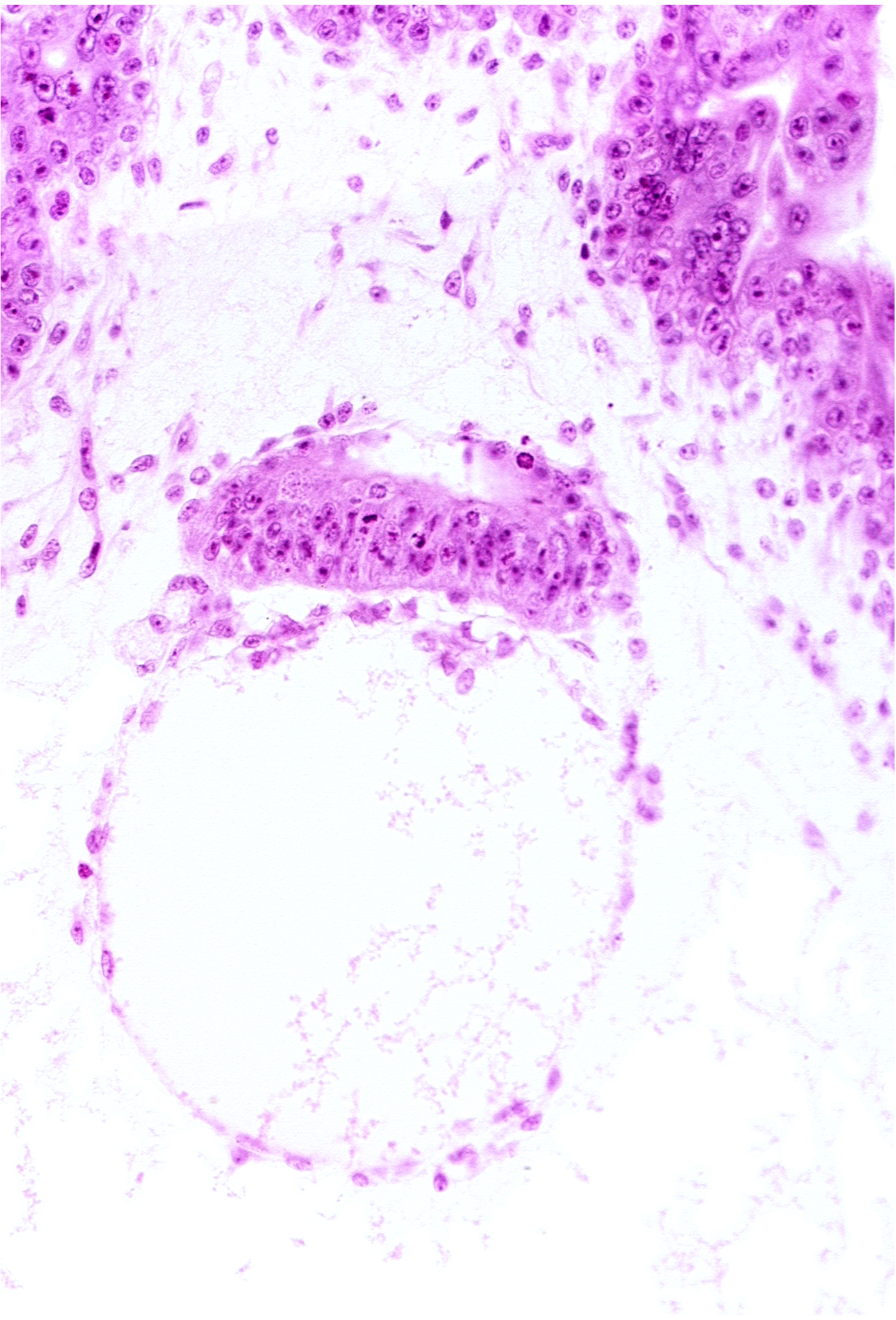 epiblast, extra-embryonic coelom, hypoblast, secondary umbilical vesicle cavity