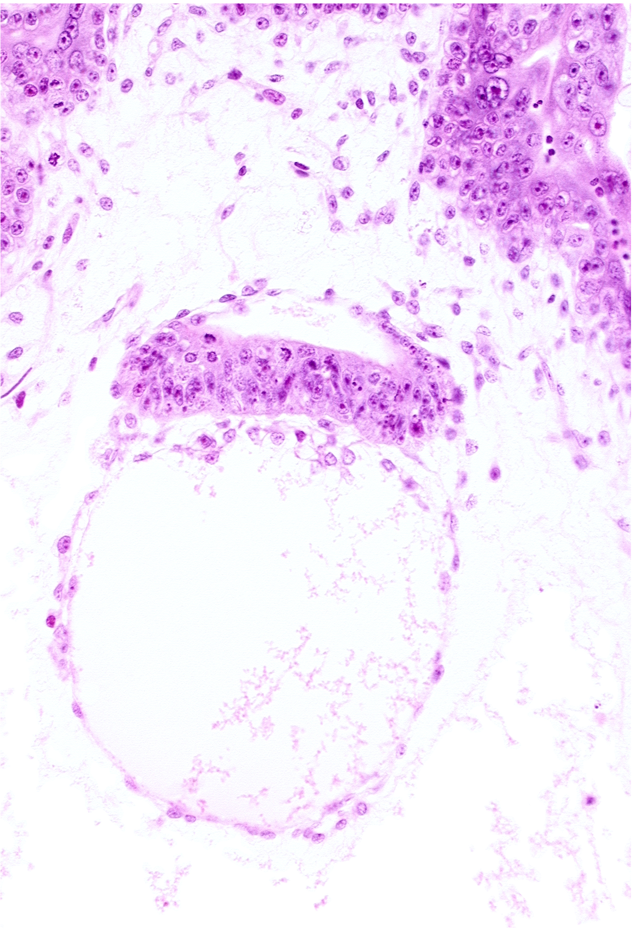 amnion, amniotic cavity, chorionic plate, embryonic disc, intervillus space(s)