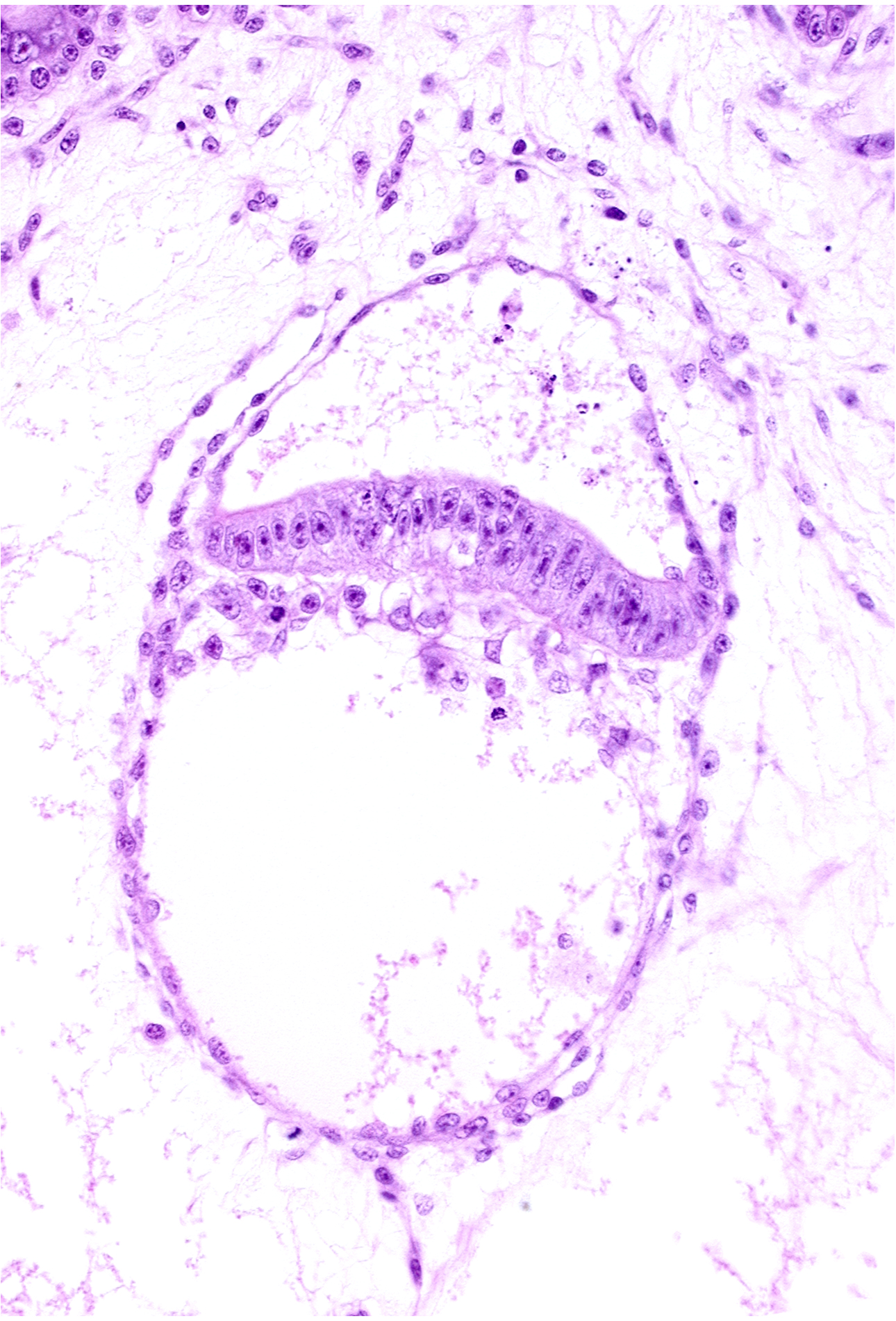 amniotic cavity, epiblast, head mesenchyme, hypoblast, junction of amnion and epiblast, secondary umbilical vesicle process, two-layered amnion