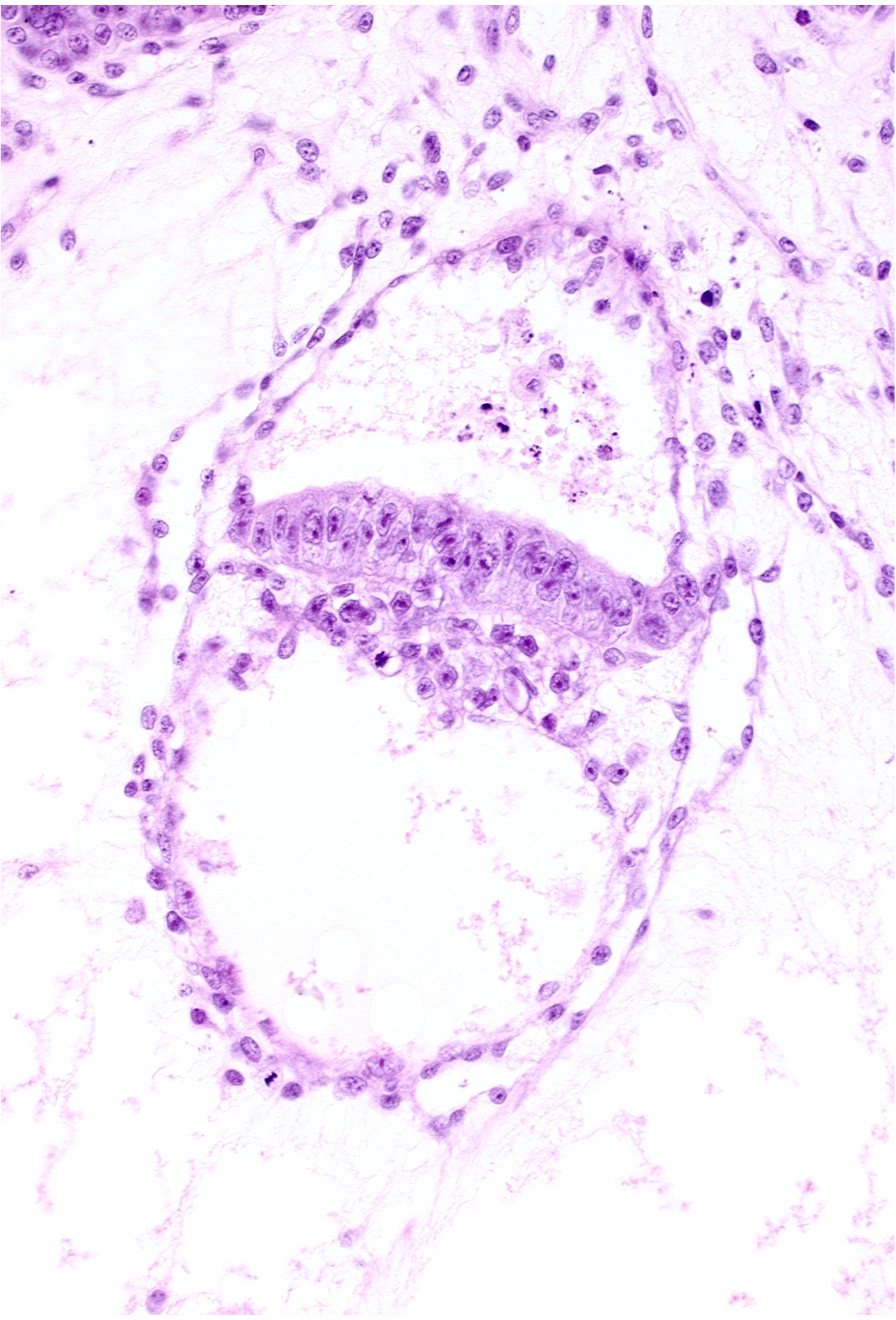 amniotic cavity, epiblast, hypoblast, intervillus space(s), secondary umbilical vesicle cavity, stem villus, two-layered amnion