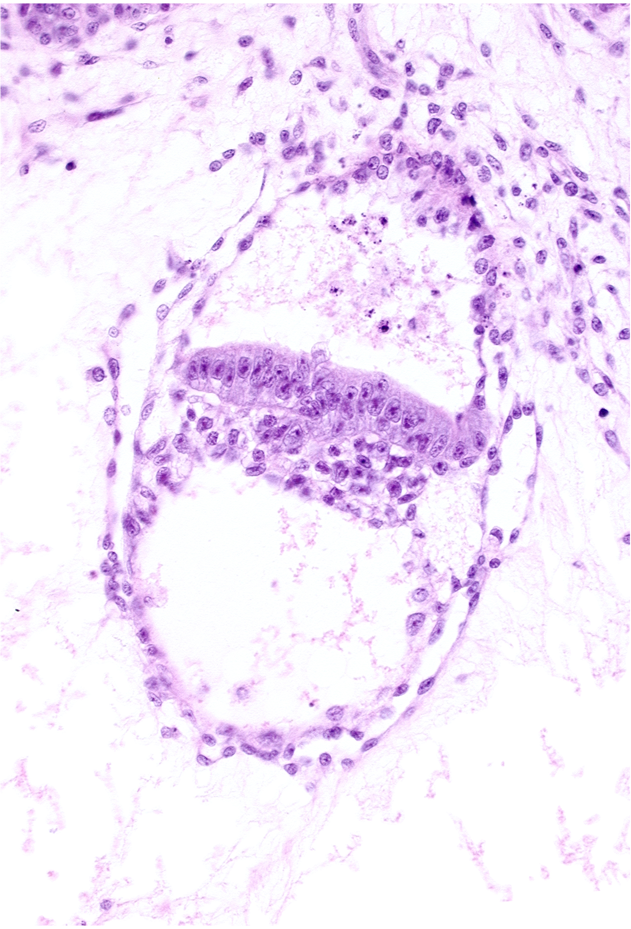 amniotic cavity, cephalic edge of presumptive amniotic duct, embryonic endoderm, embryonic mesoderm, epiblast, extra-embryonic endoderm, extra-embryonic mesoblast, presumptive gastrulation (primitive) node, primordial connecting stalk, two-layered amnion