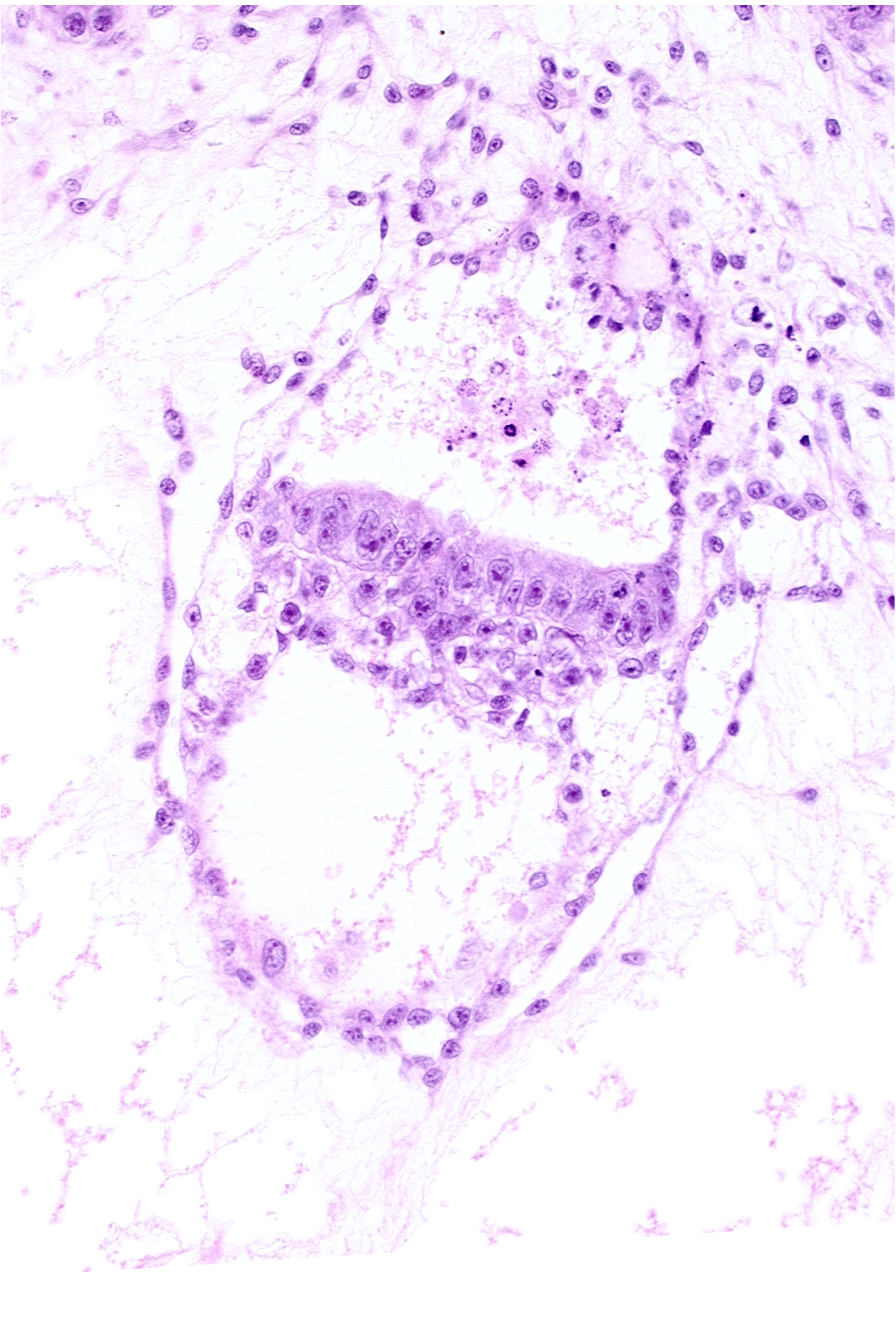 amniotic cavity, embryonic endoderm, embryonic mesoderm, primary villus, primordial gastrulation (primitive) streak, secondary umbilical vesicle cavity