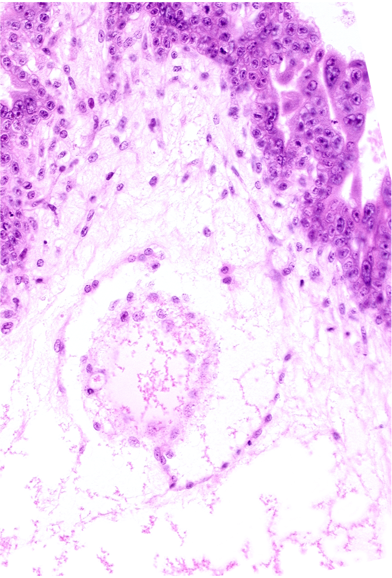 extra-embryonic coelom (exocoelom), intervillus space(s)