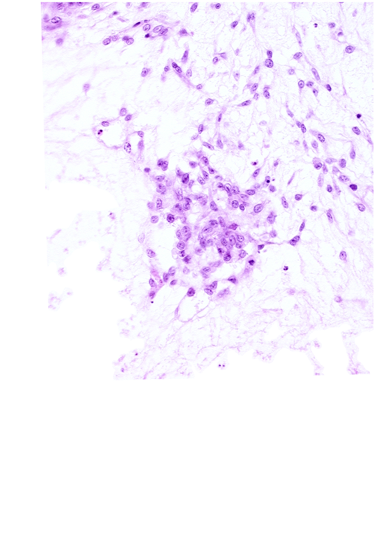 caudal edge of endodermal mass, cytotrophoblast, extra-embryonic coelom, intervillus space(s), syncytiotrophoblast