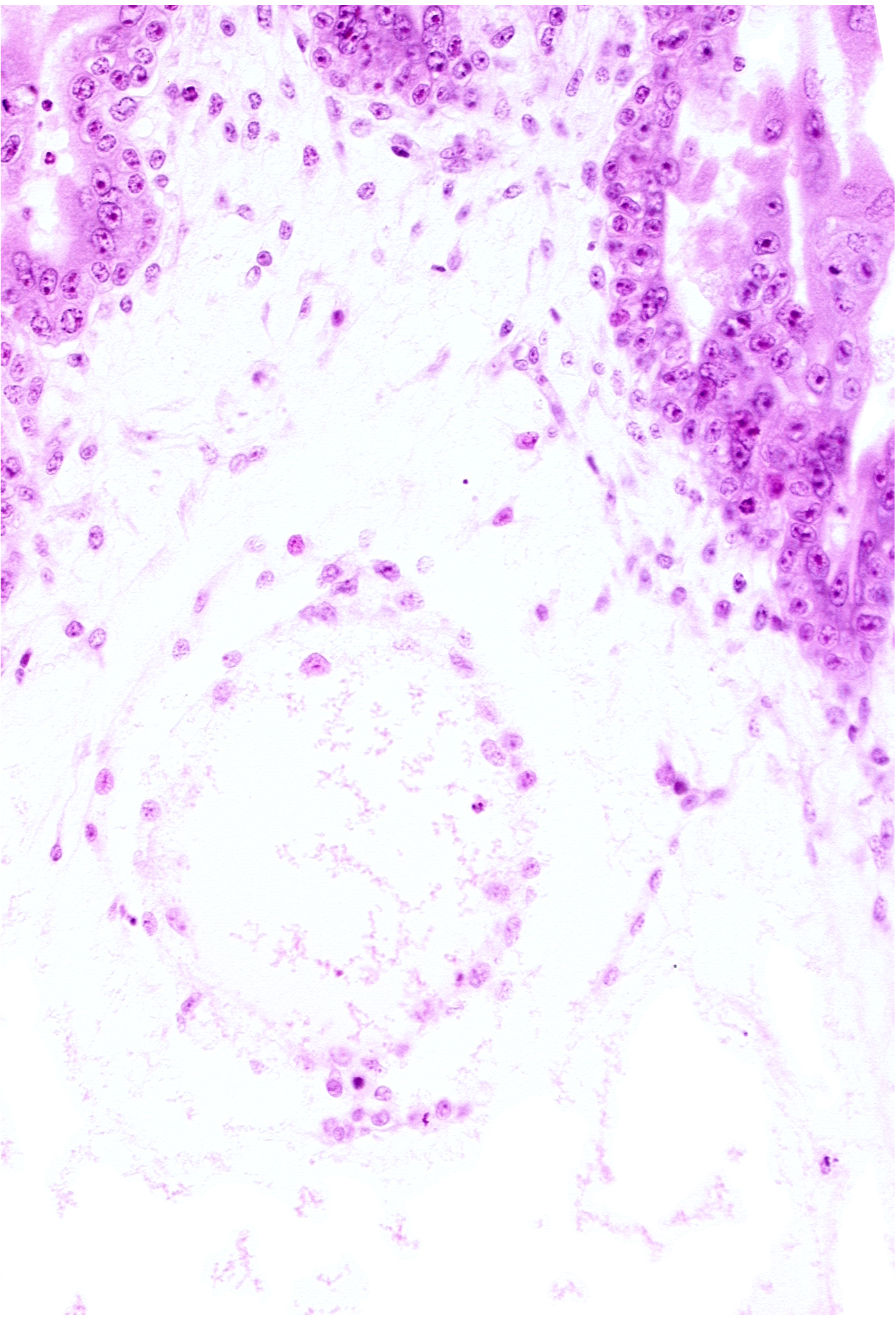 extra-embryonic coelom (exocoelom), trophoblast