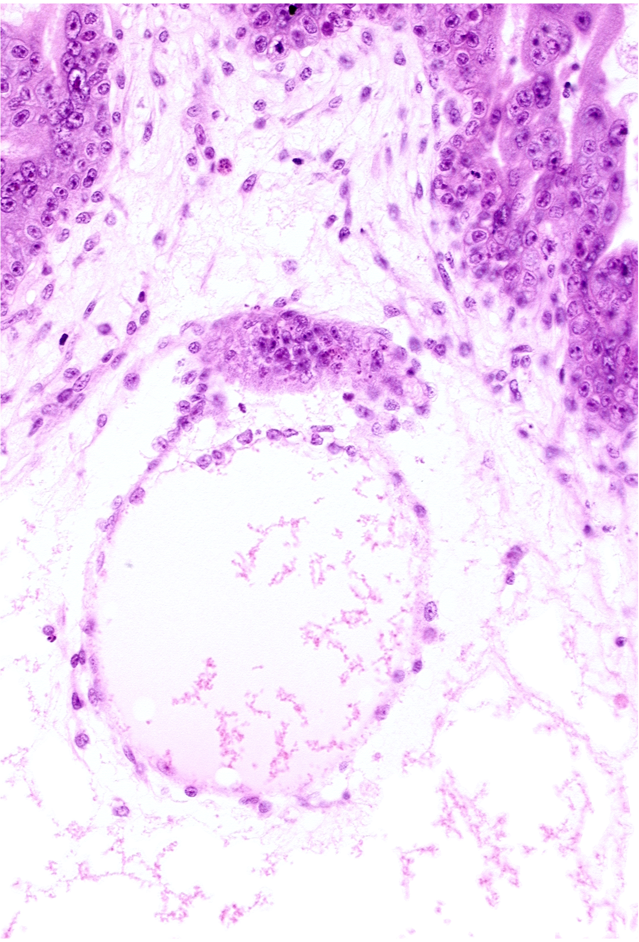 cephalic part of embryonic disc, cytotrophoblast, extra-embryonic coelom, mesoblast (mesenchyme)