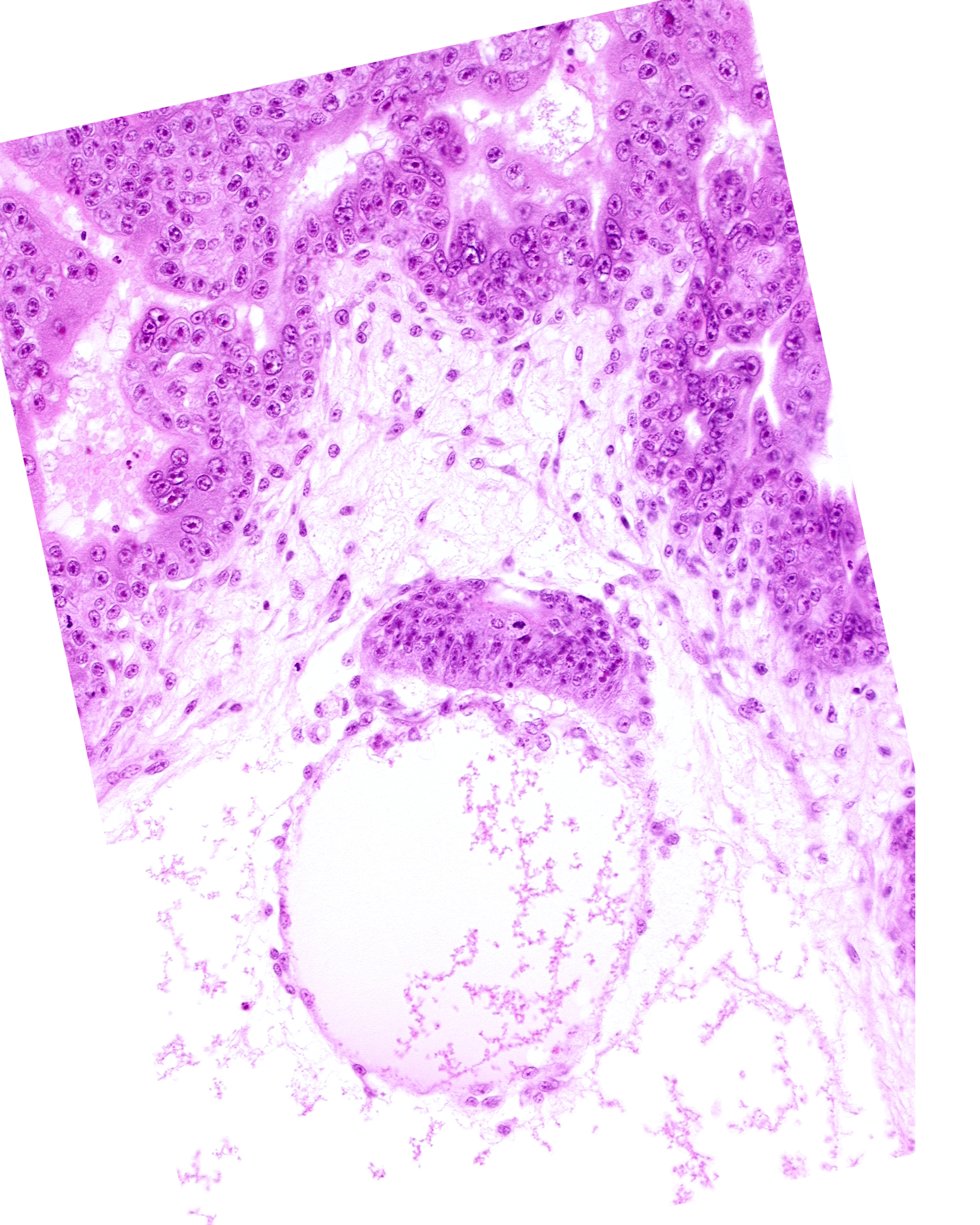 cephalic edge of amnion, cephalic edge of amniotic cavity, embryonic disc, epiblast, hypoblast, secondary umbilical vesicle cavity