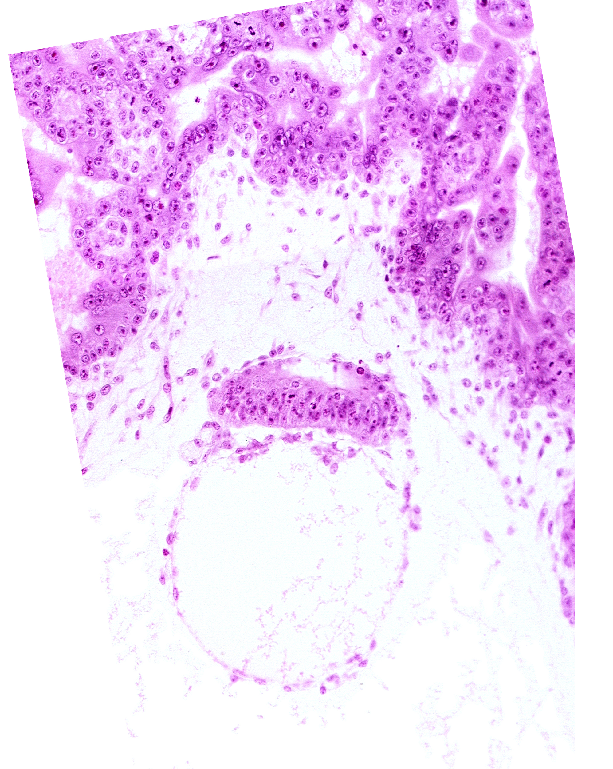 epiblast, extra-embryonic coelom, hypoblast, secondary umbilical vesicle cavity