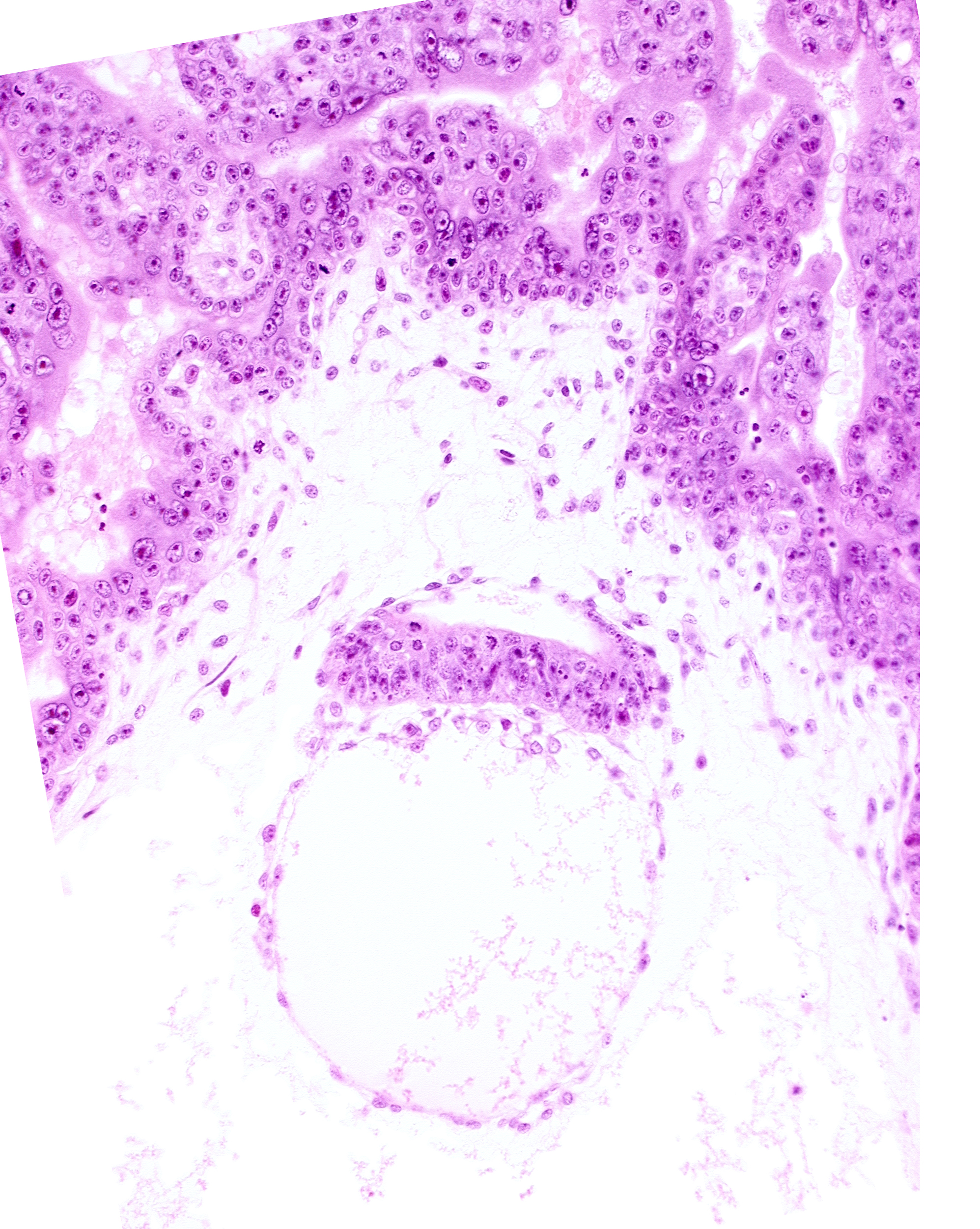 amnion, amniotic cavity, chorionic plate, embryonic disc, intervillus space(s)