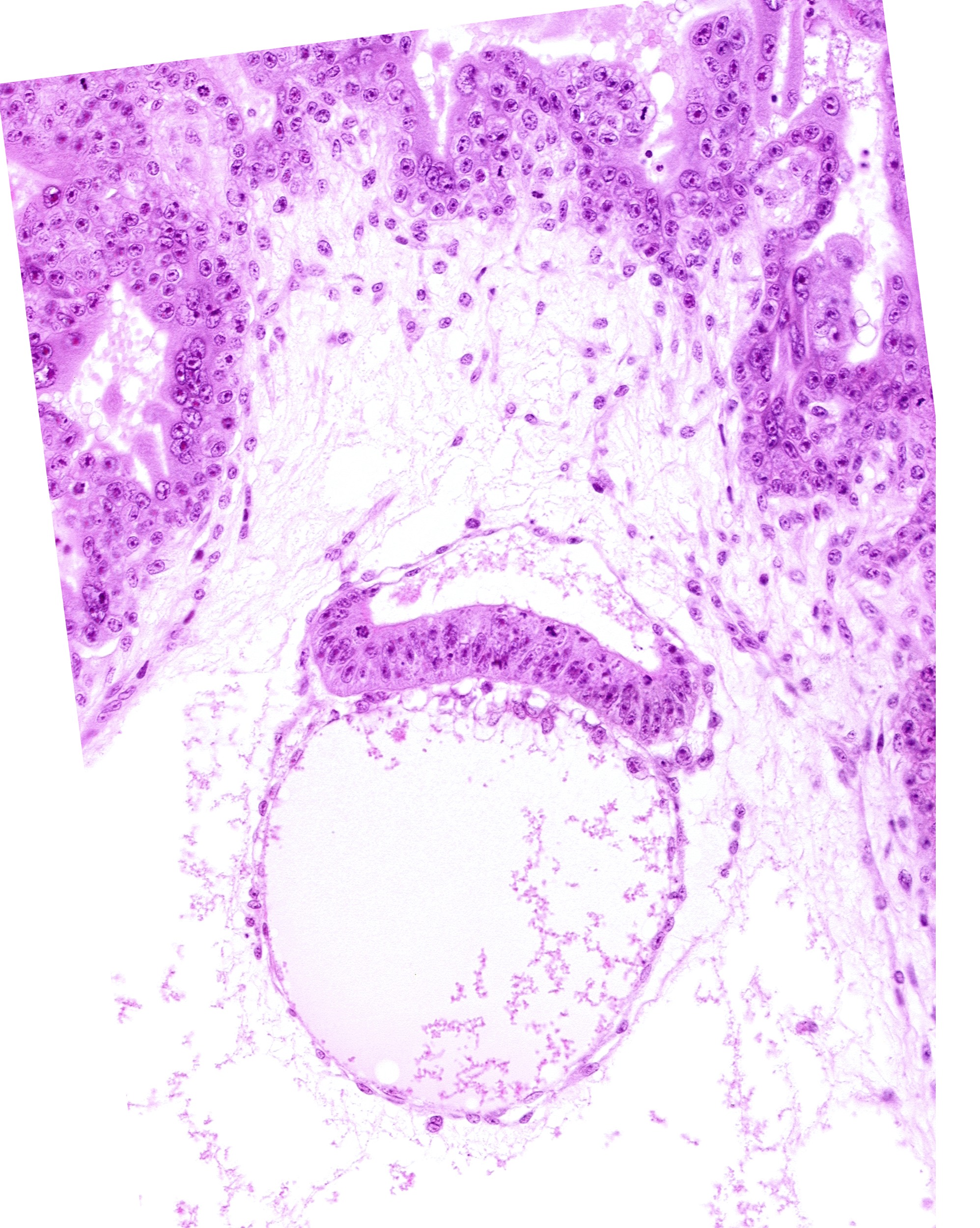 chorionic mesothelium, chorionic villi, epiblast, hypoblast, intervillus space(s), primordial connecting stalk