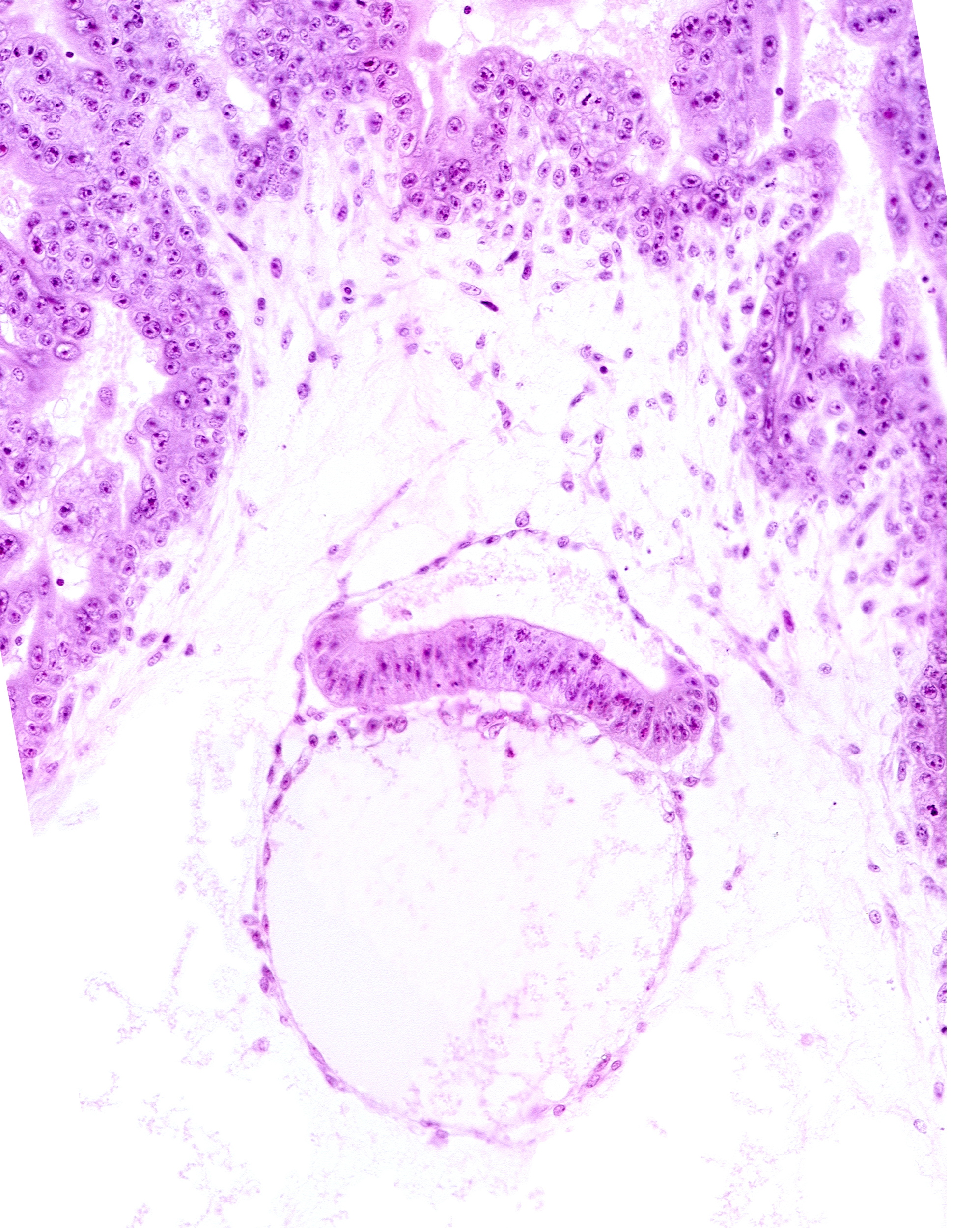 chorion, extra-embryonic coelom, head mesenchyme, hypoblast, intervillus space(s)