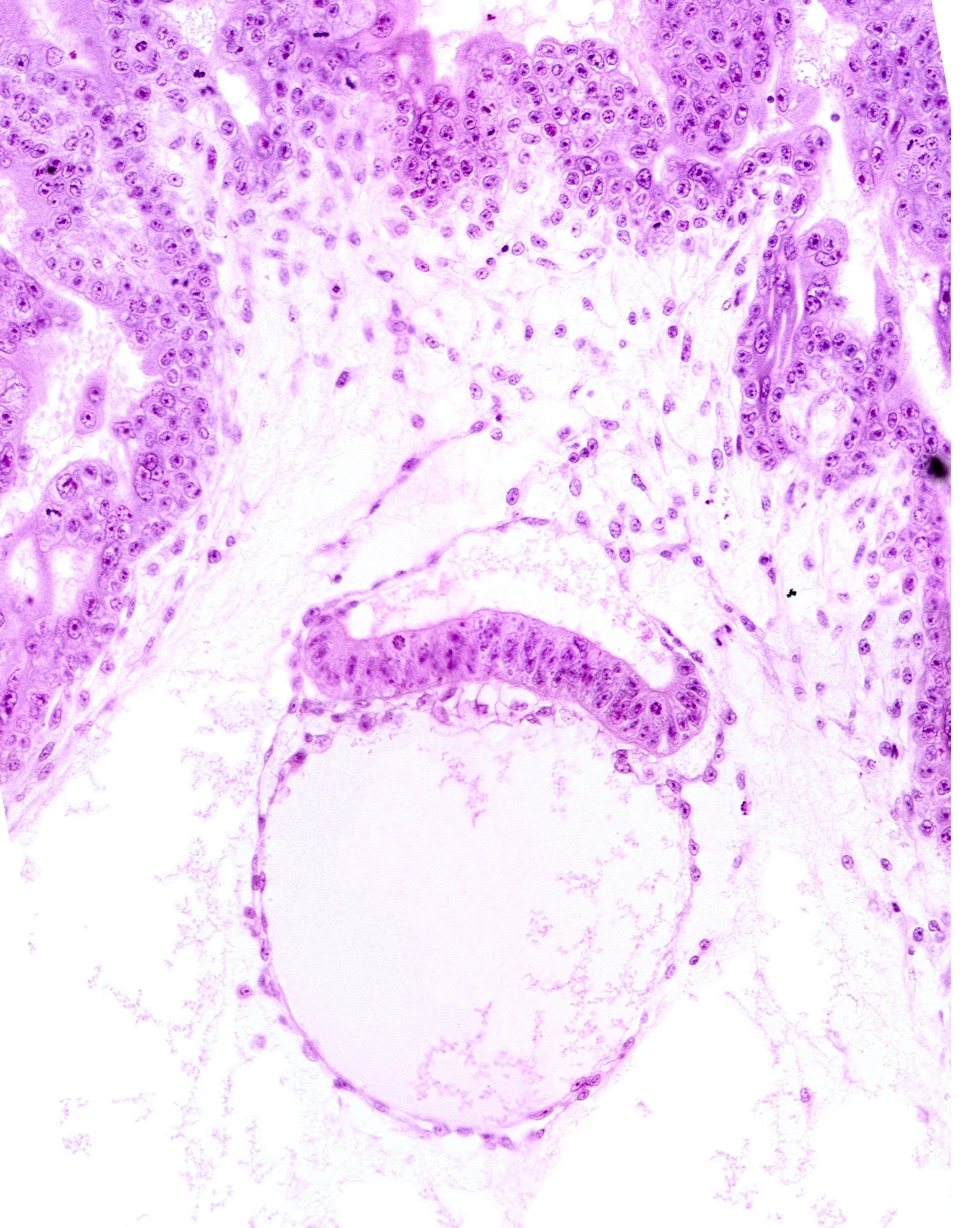 epiblast, extra-embryonic endoderm, head mesenchyme, hypoblast, mesoblast (mesenchyme), primordial blood vessel(s), tertiary villus