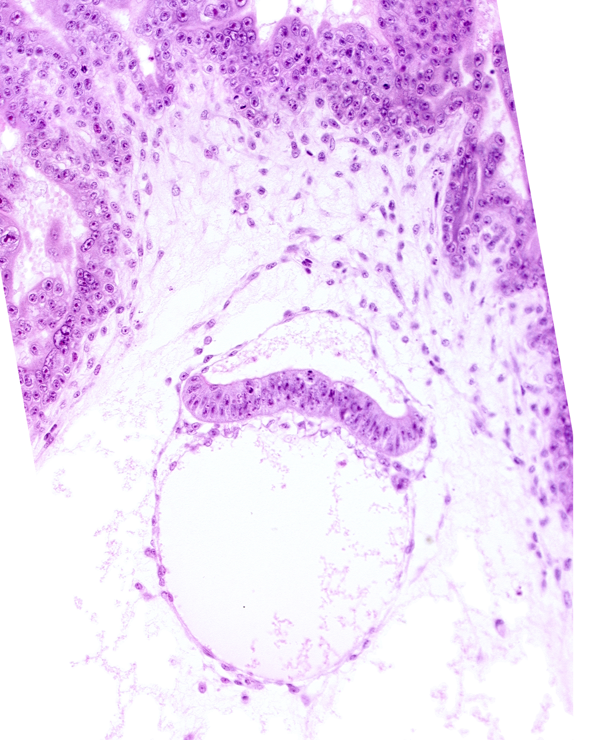 amnion, extra-embryonic coelom, intervillus space(s), secondary umbilical vesicle cavity