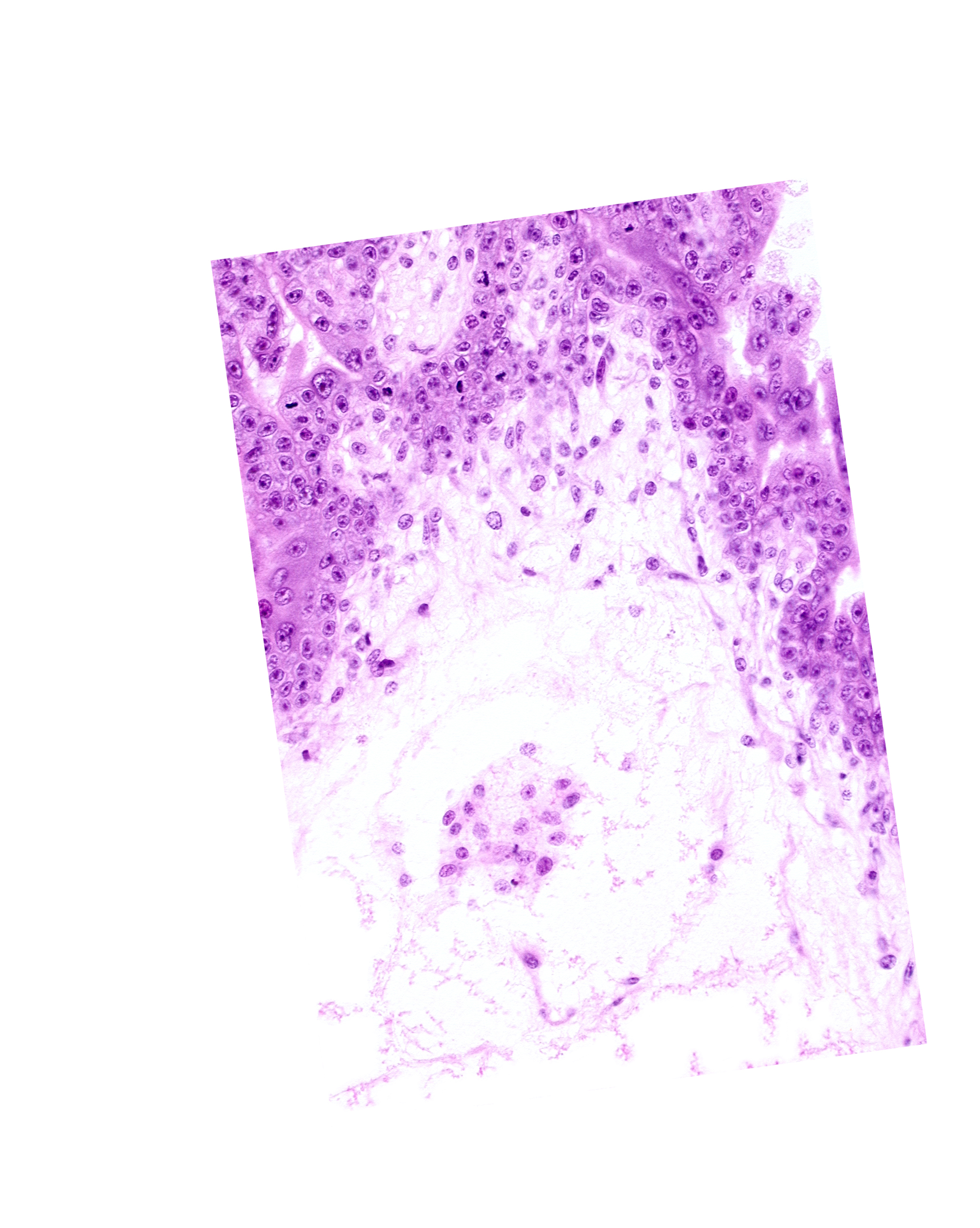 cephalic edge of secondary umbilical vesicle wall, chorion, extra-embryonic coelom (exocoelom), intervillus space(s), mesoblast (mesenchyme), trophoblast