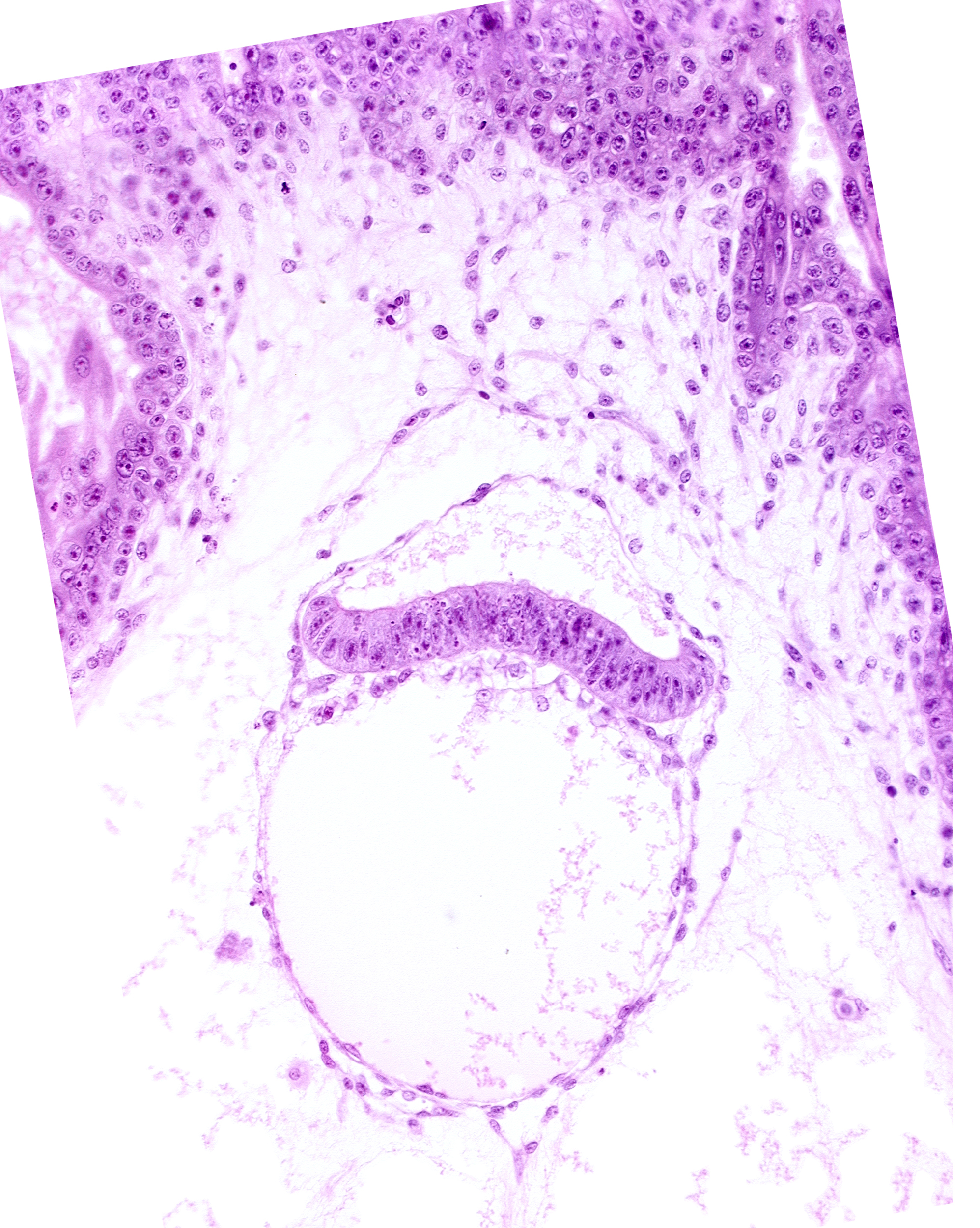 amniotic cavity, extra-embryonic coelom, head mesenchyme, hypoblast, mesoblast (mesenchyme), two-layered amnion