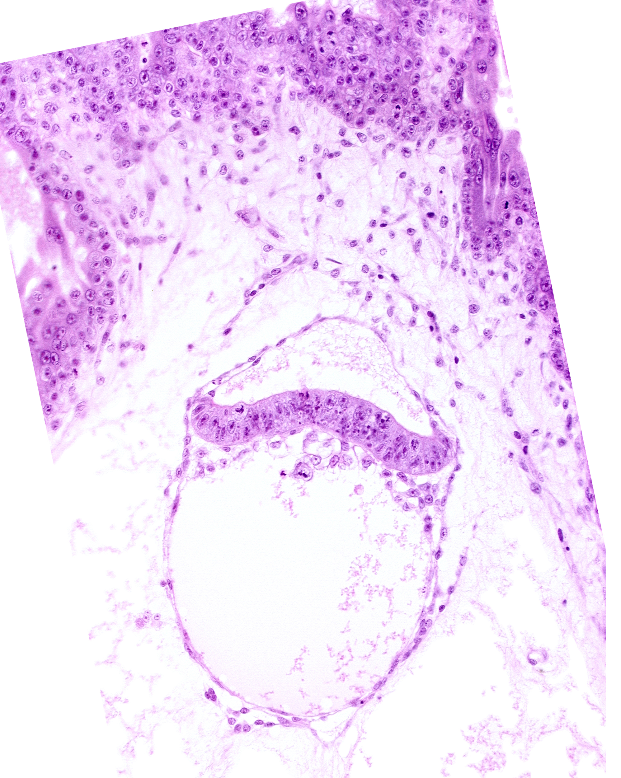 amnion, amniotic cavity, hypoblast, two-layered secondary umbilical vesicle wall