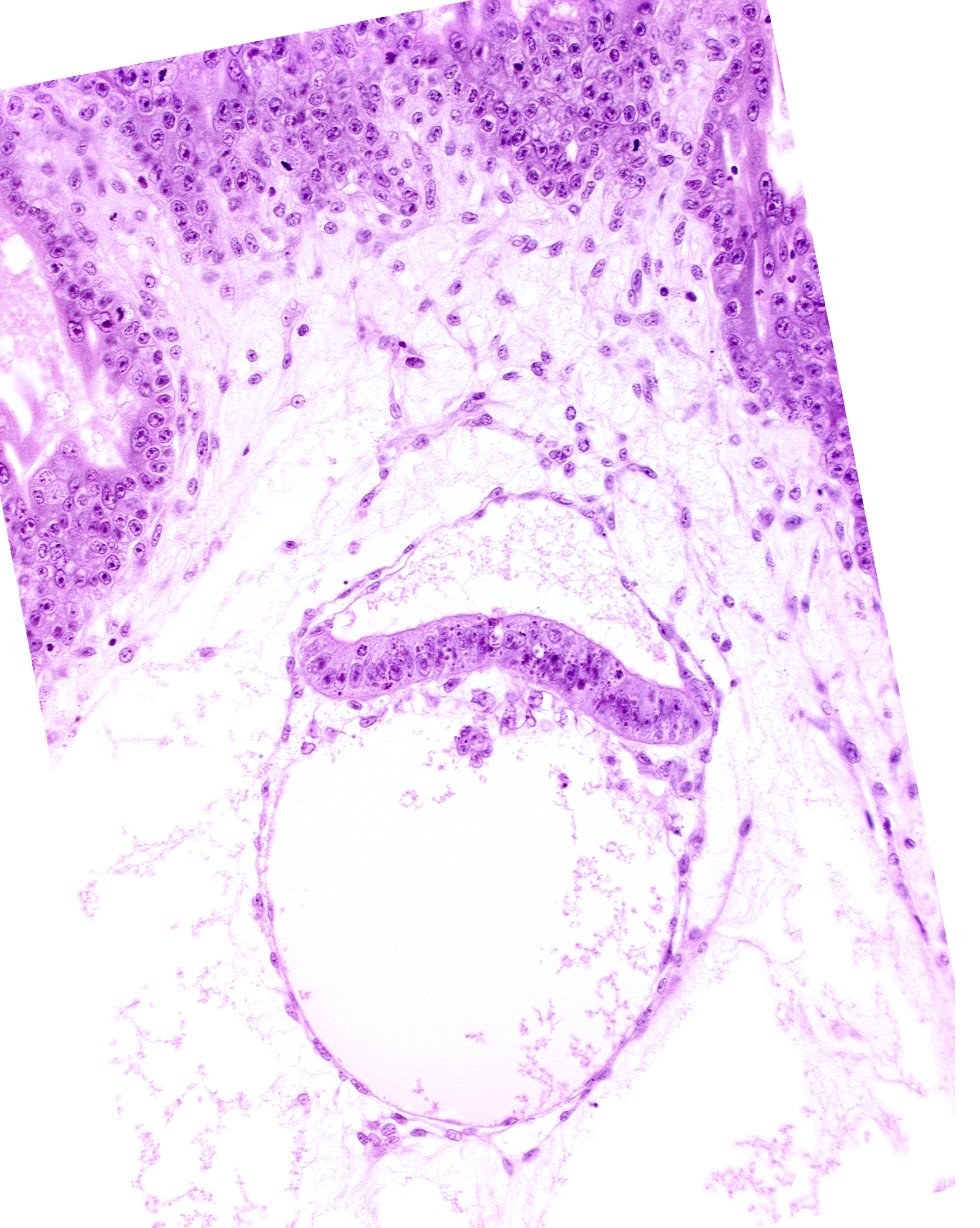 amnion, clump of cells in hypoblast, extra-embryonic coelom, intervillus space(s), junction of extra-embryonic endoderm and hypoblast, secondary umbilical vesicle process