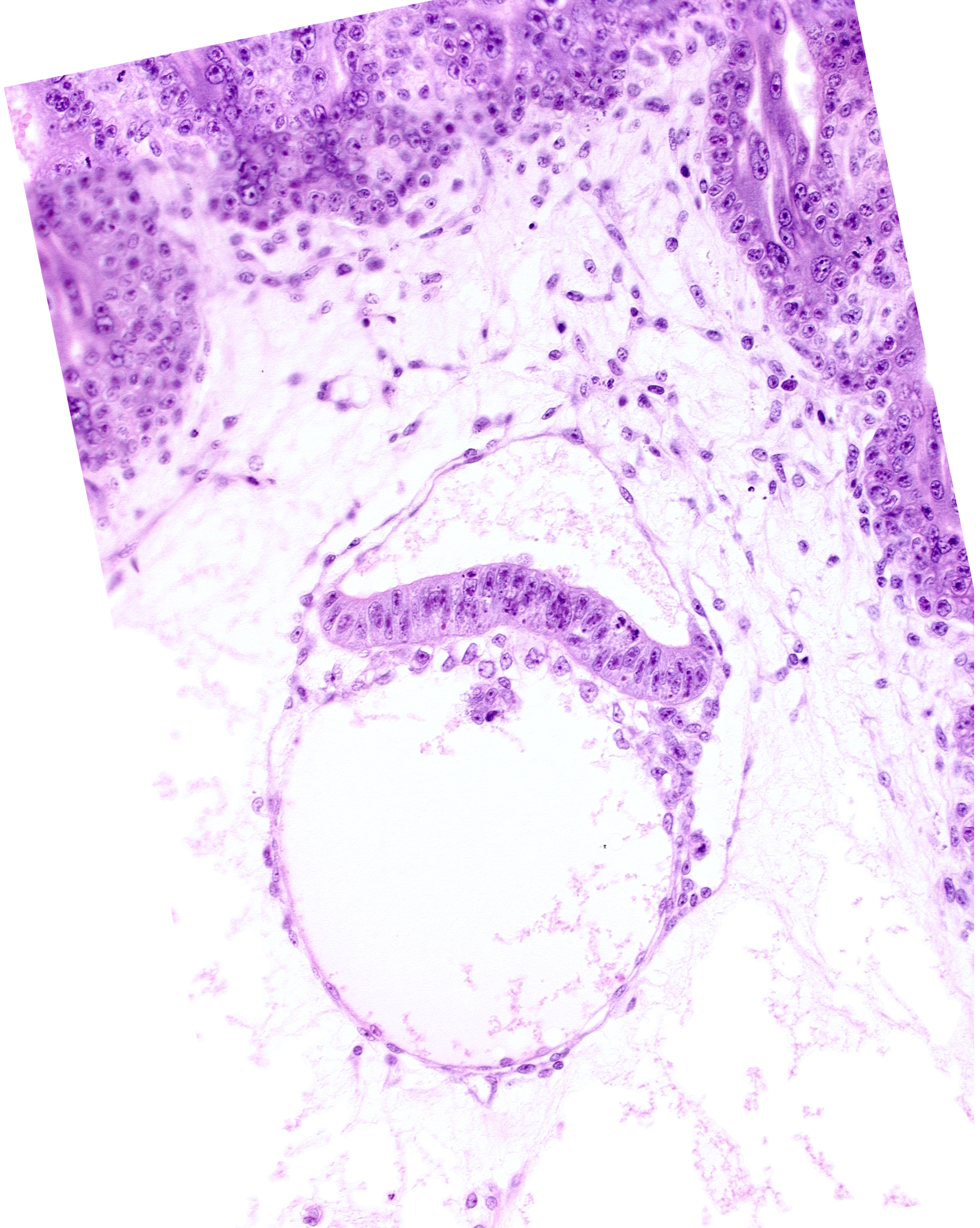 amniotic cavity, intervillus space(s), junction of extra-embryonic endoderm and hypoblast, secondary umbilical vesicle cavity