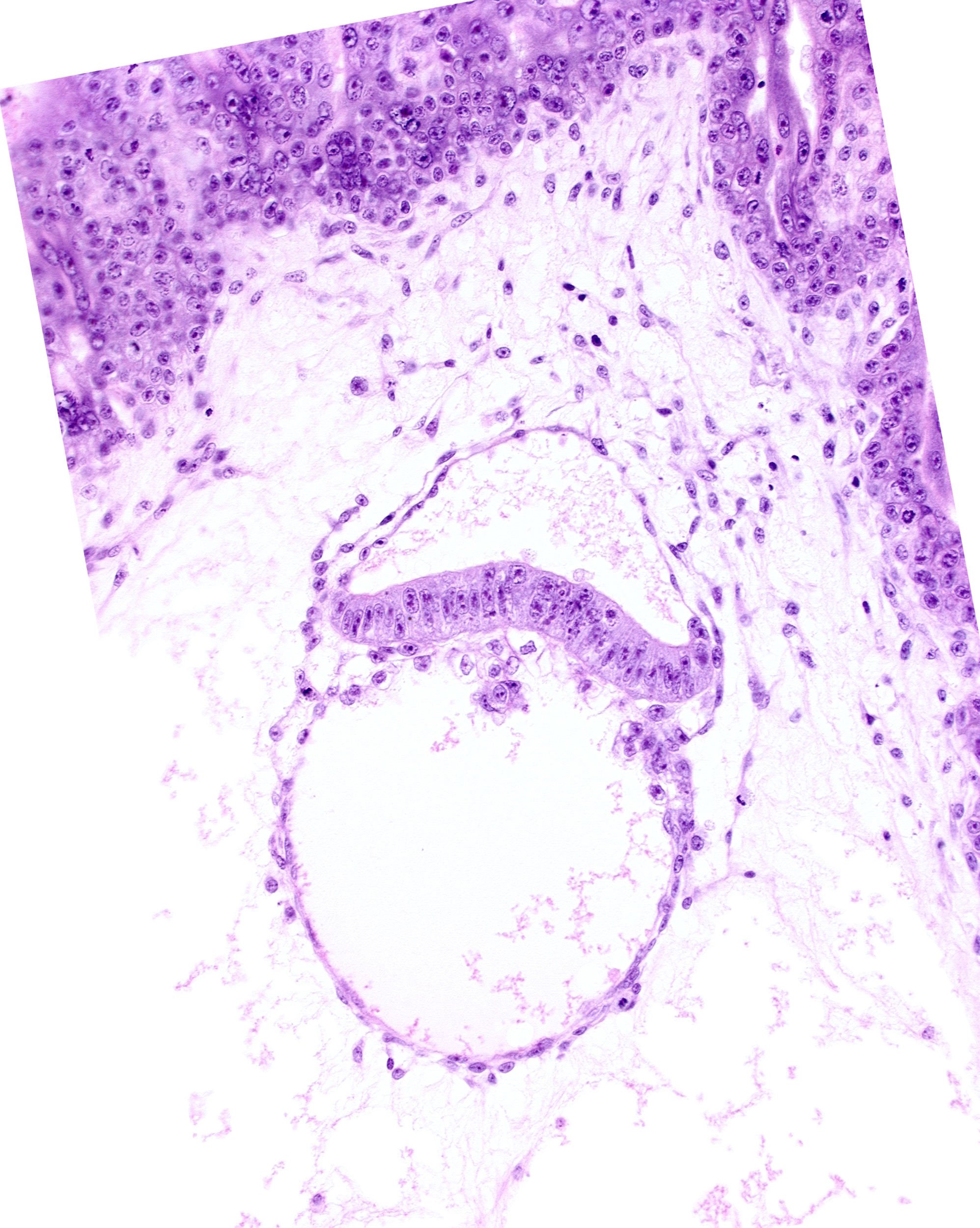 epiblast, extra-embryonic coelom, extra-embryonic ectoderm, head mesenchyme, hemangioblast, hypoblast, primordial connecting stalk, primordial germ cell(s)