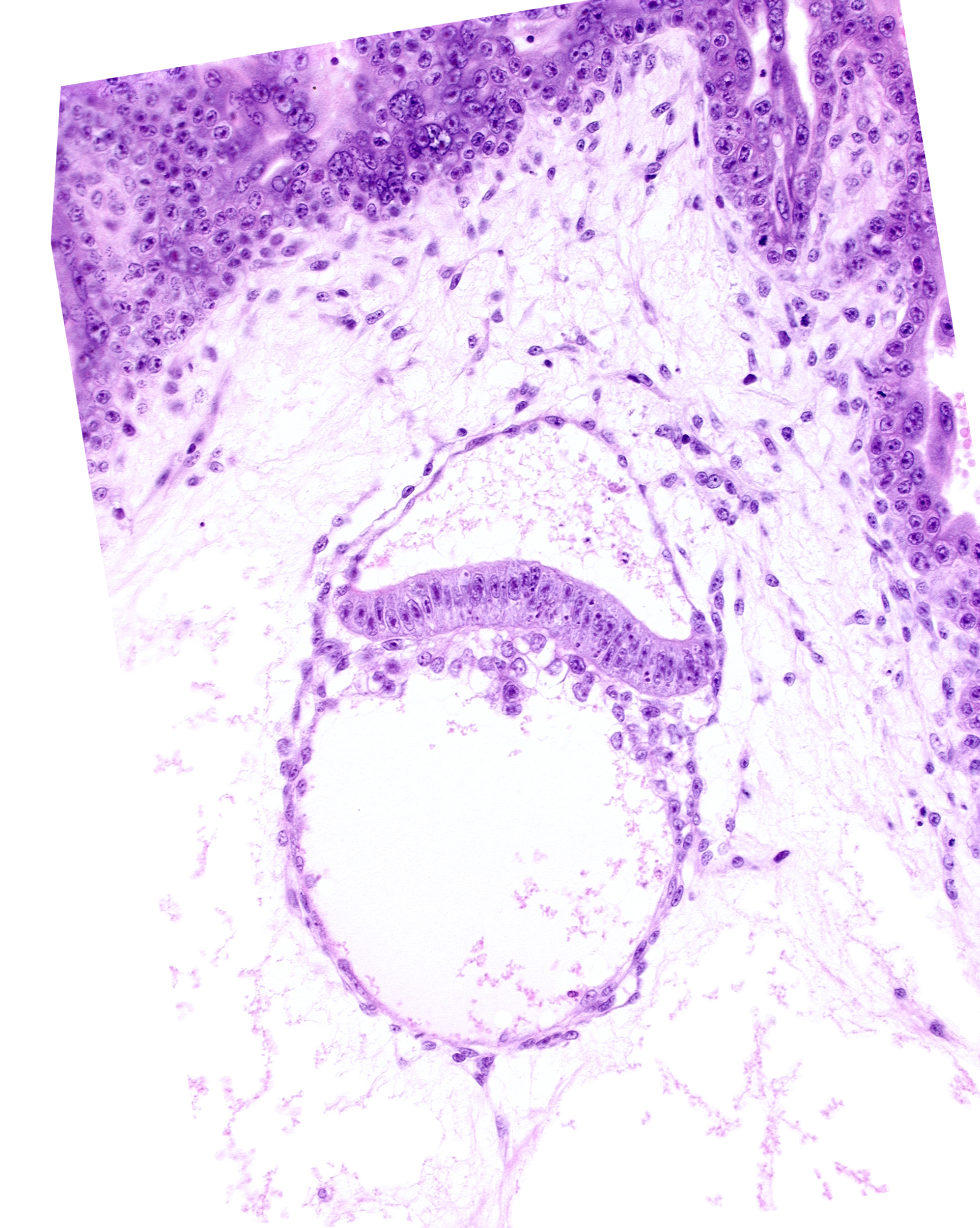 amnion, clump of cells in hypoblast, extra-embryonic endoderm, intervillus space(s)