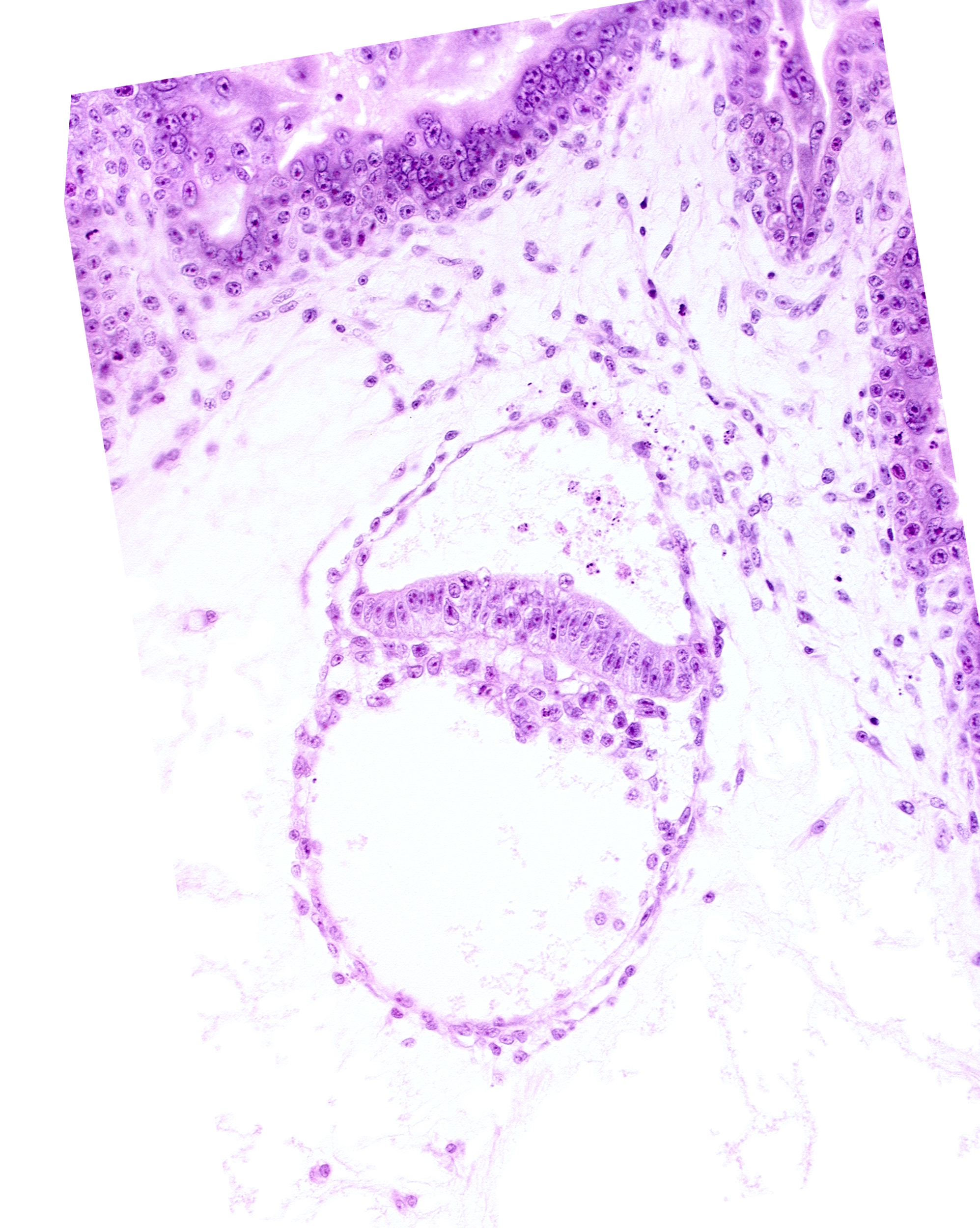 amniotic cavity, extra-embryonic coelom, extra-embryonic endoderm, head mesenchyme, secondary umbilical vesicle cavity