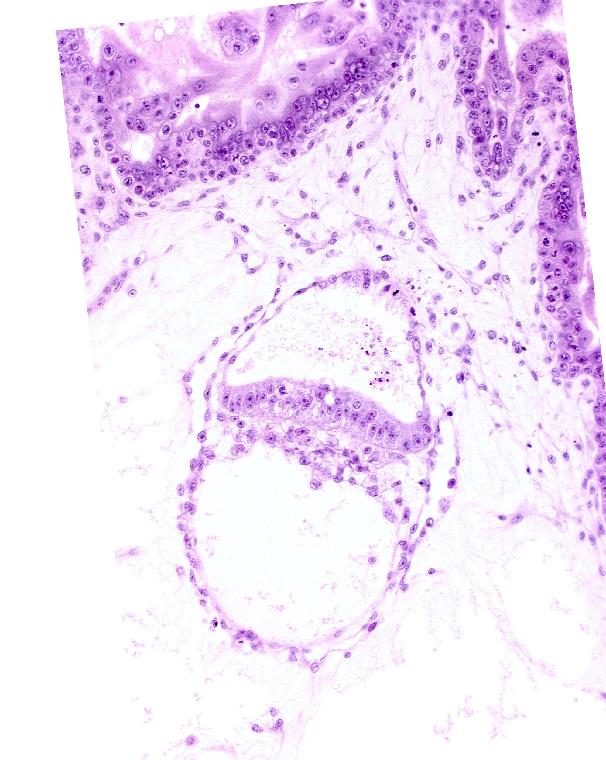 amniotic cavity, epiblast, hypoblast, presumptive prechordal plate, primordial blood vessel(s), secondary umbilical vesicle cavity