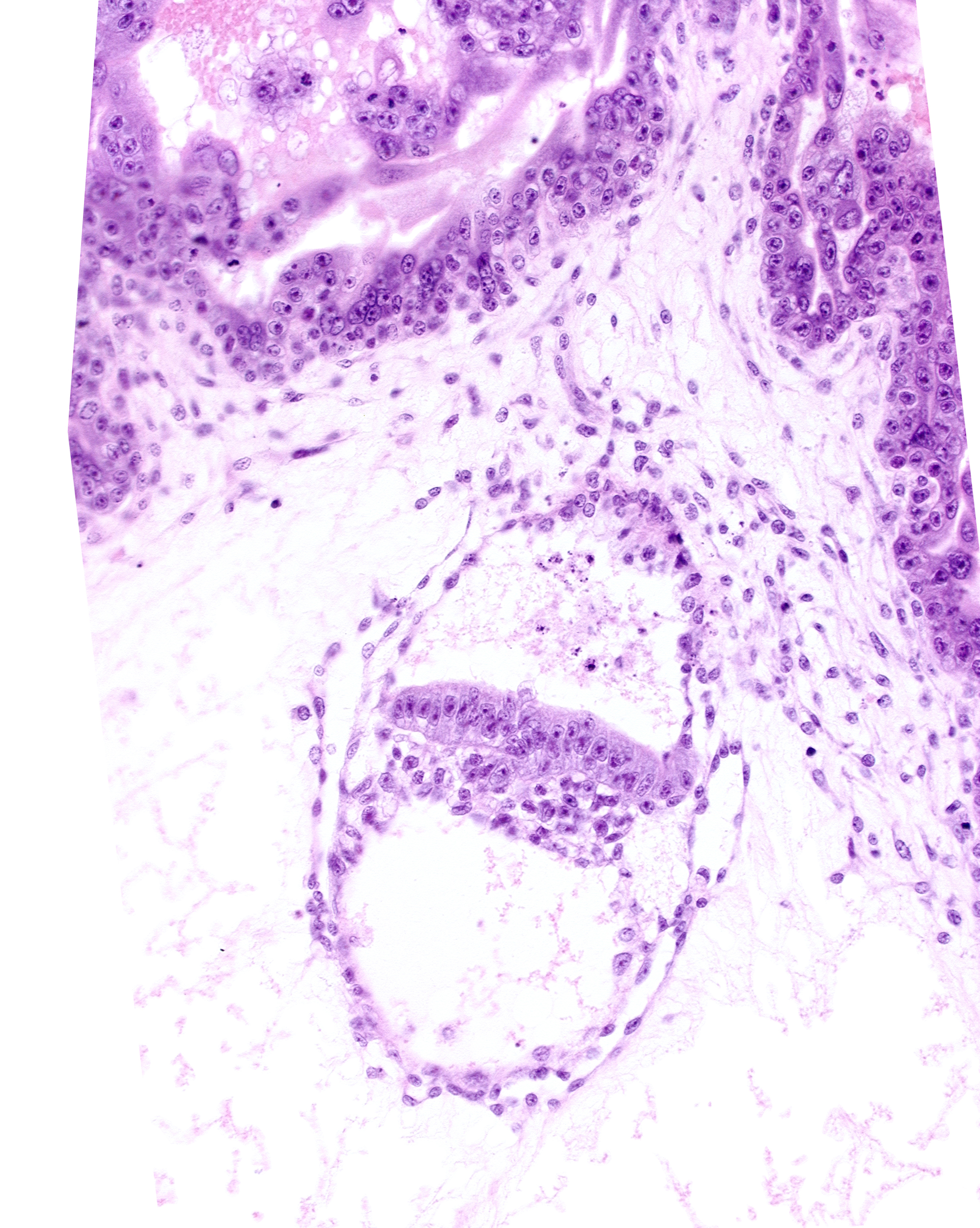 amniotic cavity, cephalic edge of presumptive amniotic duct, embryonic endoderm, embryonic mesoderm, epiblast, extra-embryonic endoderm, extra-embryonic mesoblast, presumptive gastrulation (primitive) node, primordial connecting stalk, two-layered amnion