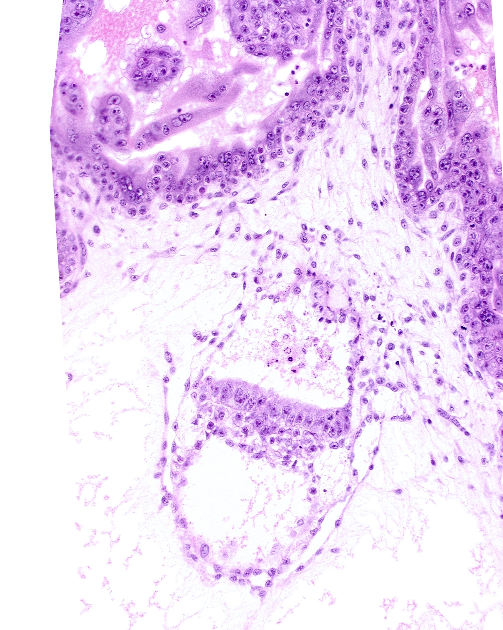 amniotic cavity, embryonic endoderm, embryonic mesoderm, primary villus, primordial gastrulation (primitive) streak, secondary umbilical vesicle cavity