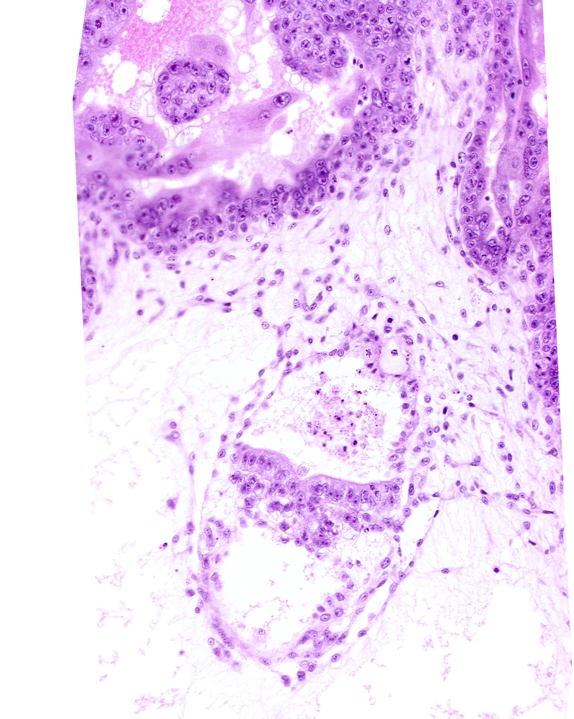 caudal part of secondary umbilical vesicle cavity, cephalic part of primordial gastrulation (primitive) groove, embryonic endoderm, epiblast, extra-embryonic endoderm, intervillus space(s), presumptive amniotic duct, primary villus, site of epitheliomesenchymal transformation, stem villus