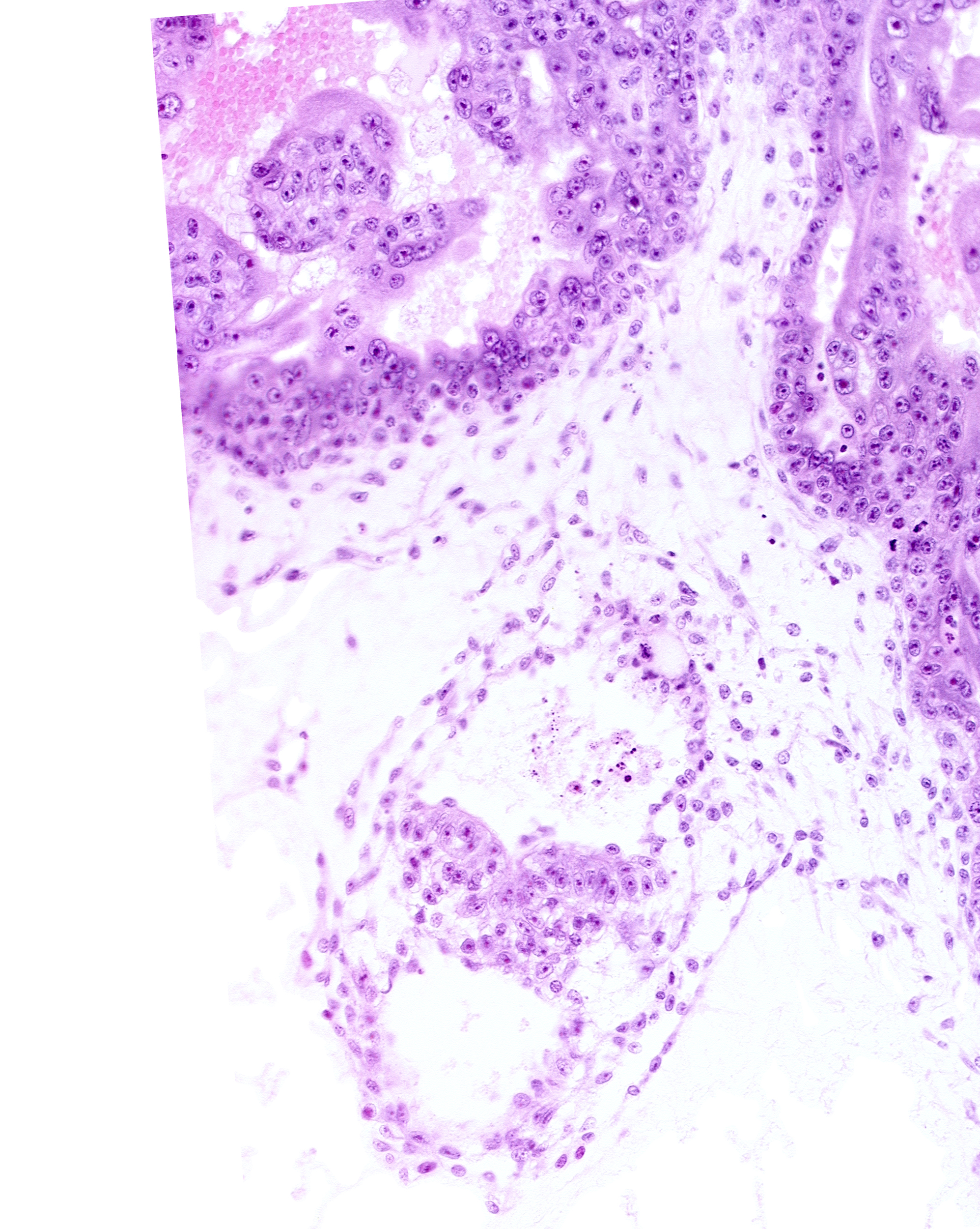 amniotic cavity, caudal end of primordial gastrulation (primitive) streak, extra-embryonic mesoderm (mesenchyme), intervillus space(s), primary villus, primordial connecting stalk, stem villus