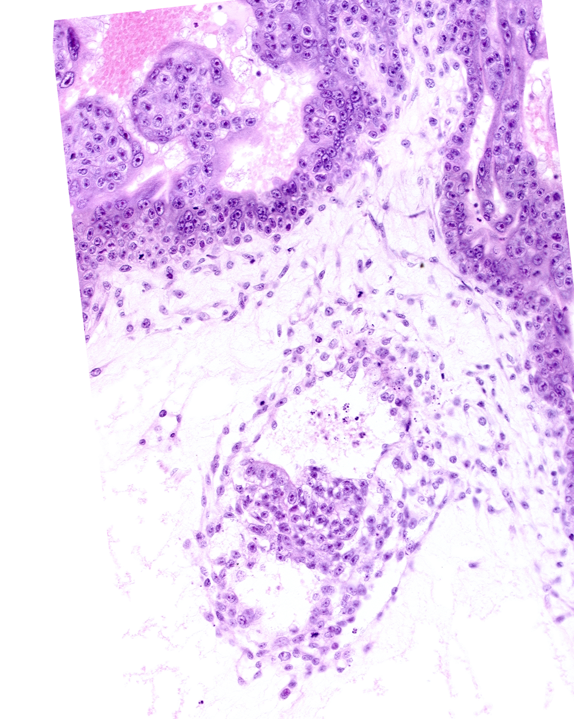 amniotic cavity, caudal edge of presumptive amniotic duct, caudal end of primordial gastrulation (primitive) groove, caudal end of primordial gastrulation (primitive) streak, caudal part of secondary umbilical vesicle cavity, epiblast, mesoderm, presumptive cloacal membrane, primordial germ cell(s)