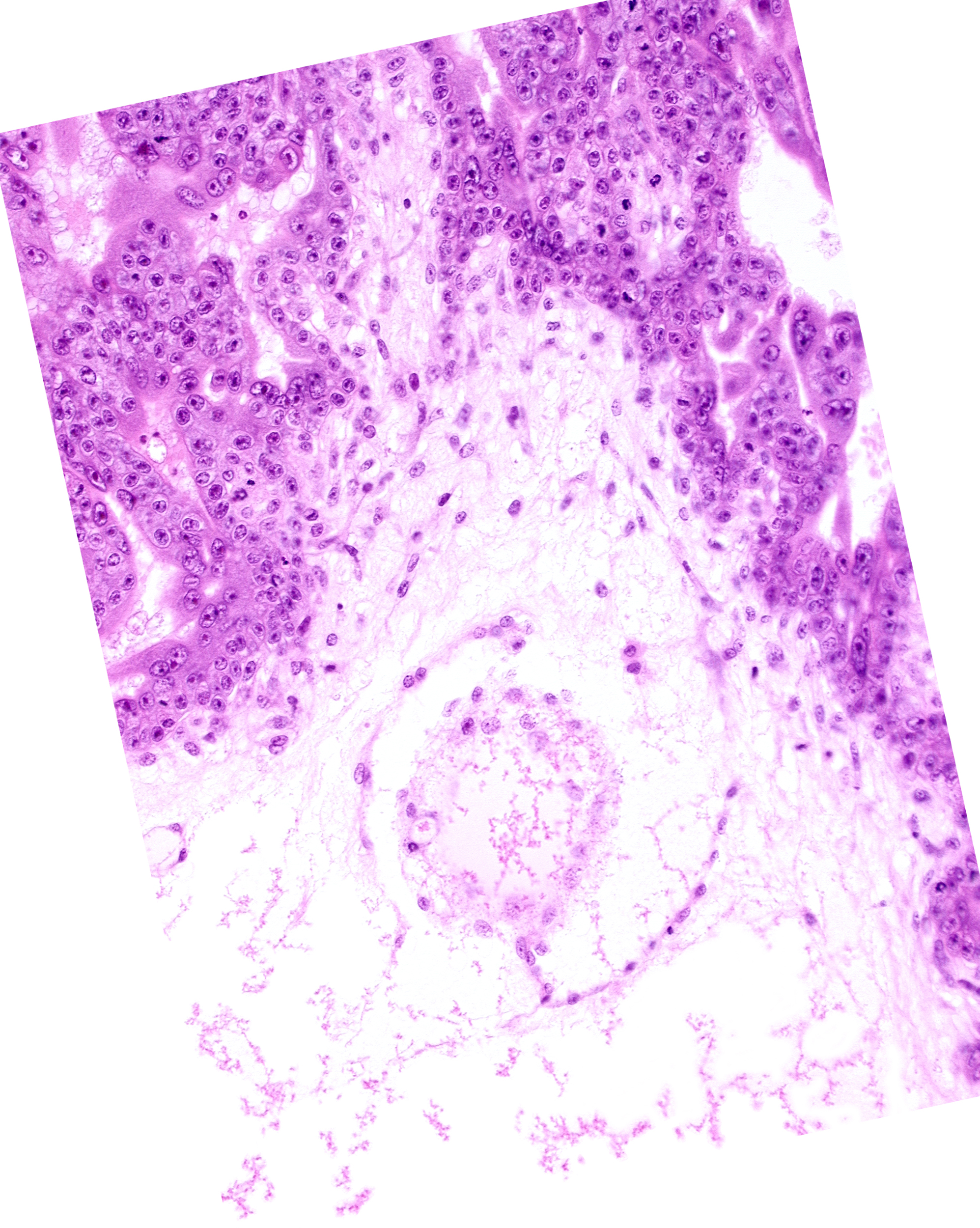 extra-embryonic coelom (exocoelom), intervillus space(s)