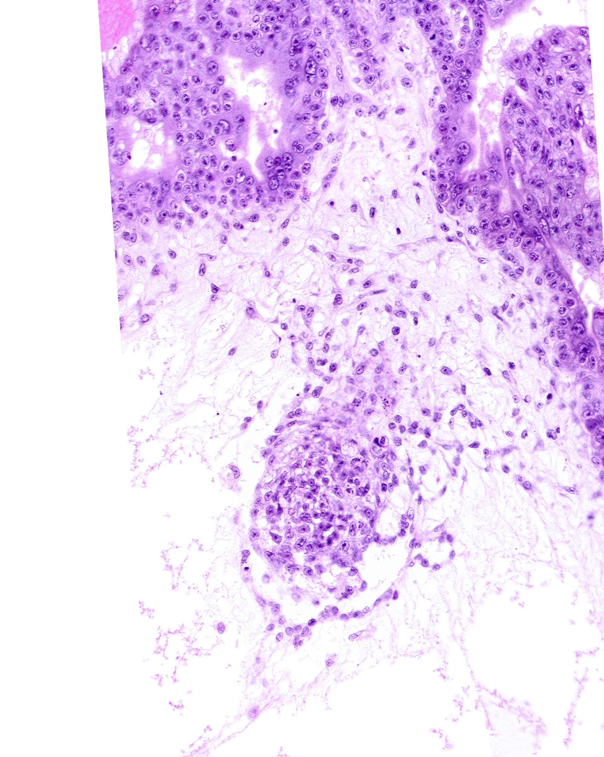 caudal edge of specialized cells in amnion, cytotrophoblast, endodermal mass, intervillus space(s), primordial connecting stalk, primordial germ cell(s), syncytiotrophoblast
