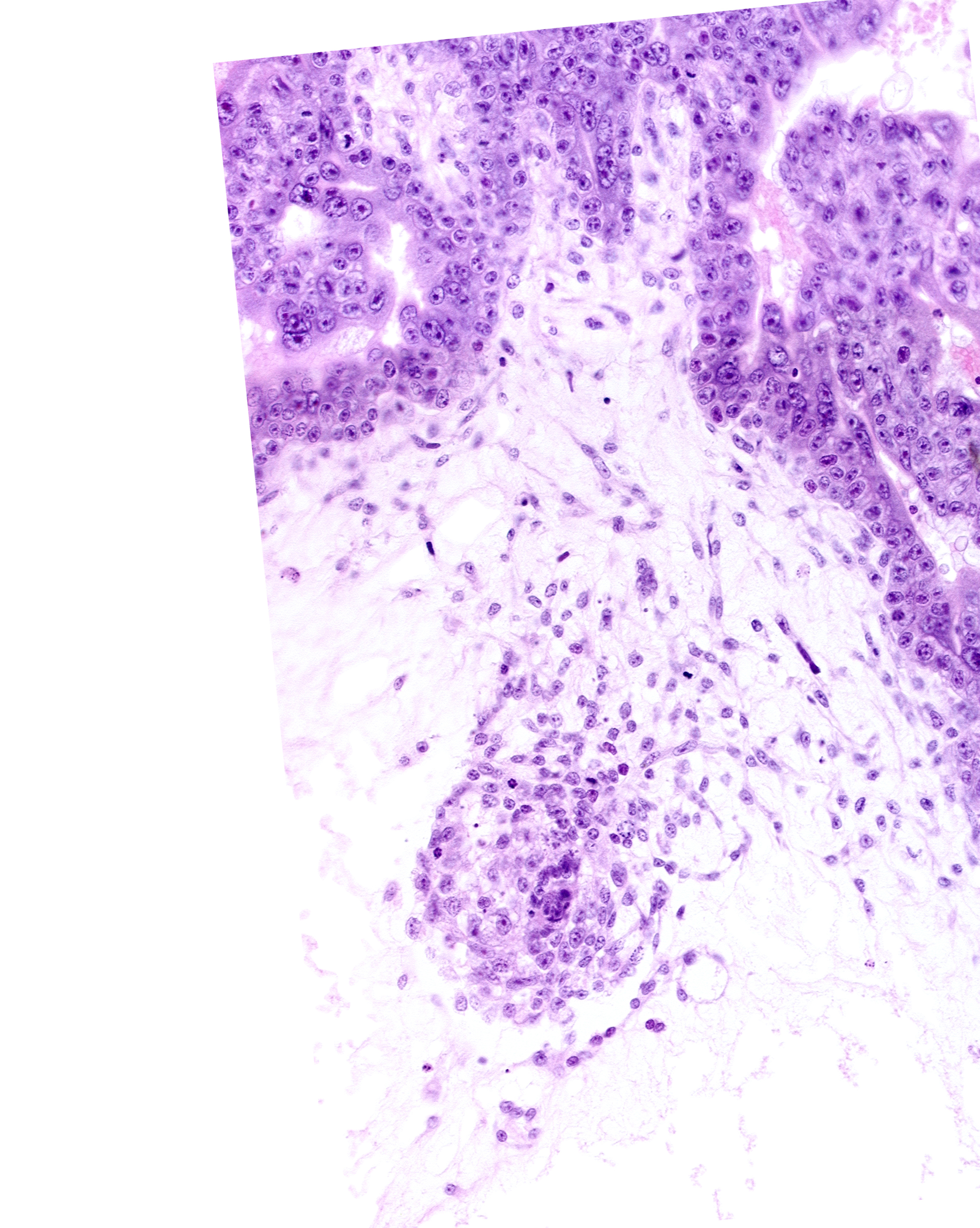 chorion, endodermal mass, hemangioblastic tissue, intervillus space(s), primordial connecting stalk, secondary umbilical vesicle process, syncytiotrophoblast