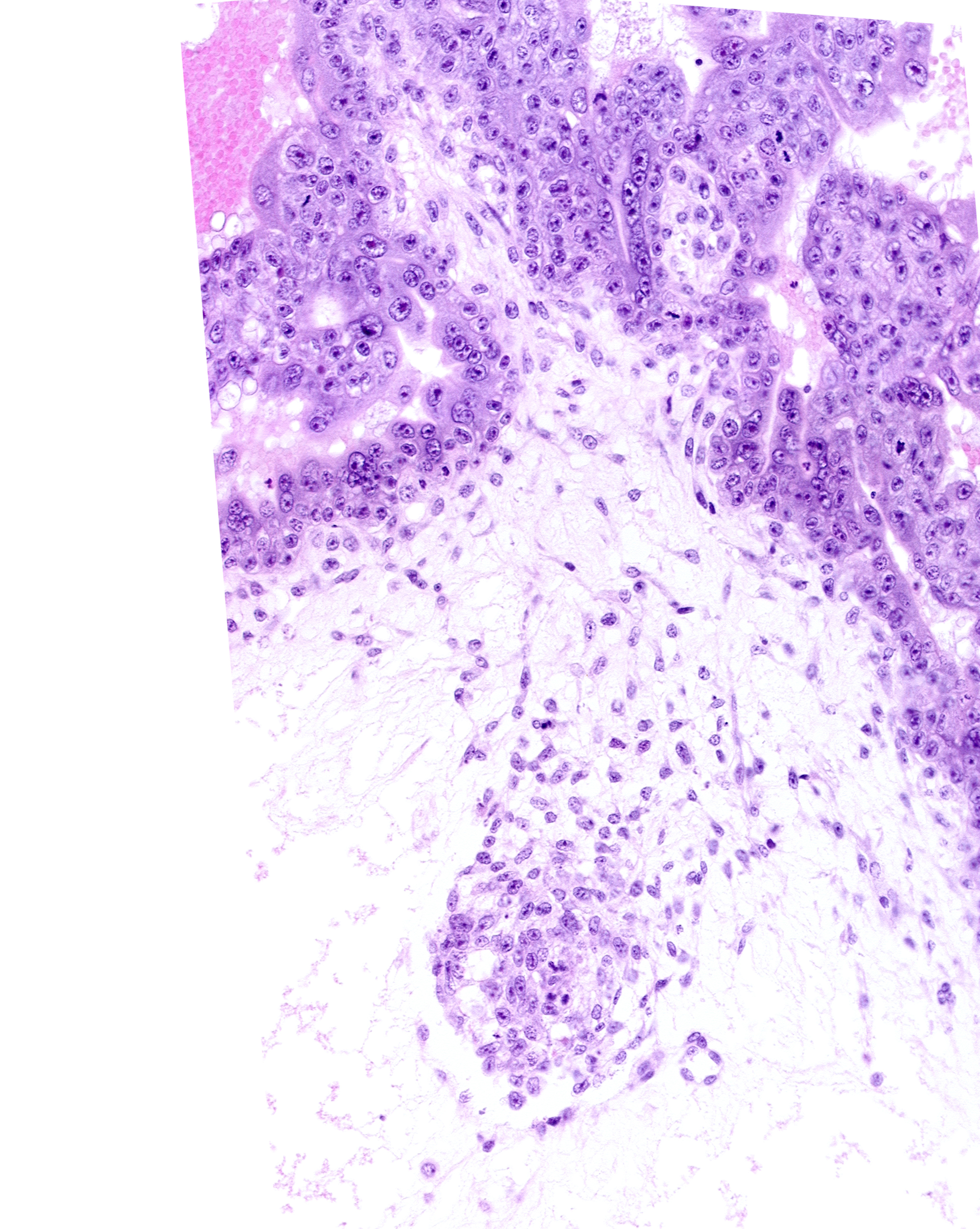 extra-embryonic mesoblast, intervillus space(s), primordial blood vessel(s), syncytiotrophoblast